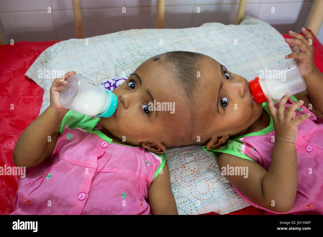 Dhaka, Bangladesh. 29 juillet, 2017. DHAKA, BANGLADESH - 29 juillet : lits jumeaux siamois filles Rabeya l'Islam et l'Islam Rokeya boire du lait dans un hôpital à Dhaka, Bangladesh, le 29 juillet 2017. Taslima Khatun, professeur d'école, a donné une naissance de jumeaux siamois le dirigé le 16 juillet 2016 après une césarienne. Les jumeaux ont été admis à un hôpital du gouvernement pour examen avant la chirurgie potentiellement à séparer leurs têtes. Zakir Hossain Chowdhury Crédit : zakir/Alamy Live News Banque D'Images