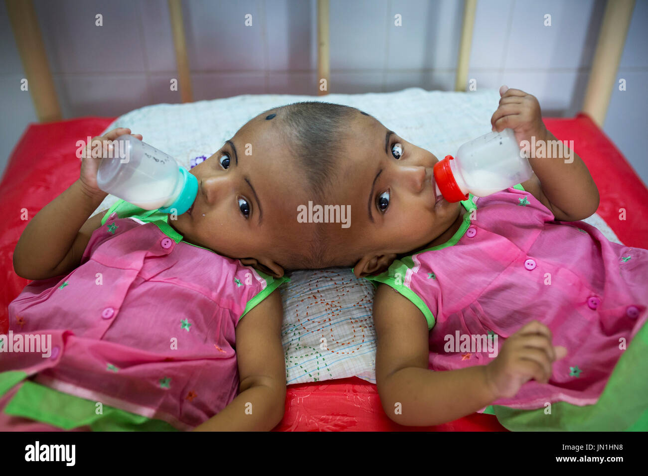 Dhaka, Bangladesh. 29 juillet, 2017. DHAKA, BANGLADESH - 29 juillet : lits jumeaux siamois filles Rabeya l'Islam et l'Islam Rokeya boire du lait dans un hôpital à Dhaka, Bangladesh, le 29 juillet 2017. Taslima Khatun, professeur d'école, a donné une naissance de jumeaux siamois le dirigé le 16 juillet 2016 après une césarienne. Les jumeaux ont été admis à un hôpital du gouvernement pour examen avant la chirurgie potentiellement à séparer leurs têtes. Zakir Hossain Chowdhury Crédit : zakir/Alamy Live News Banque D'Images