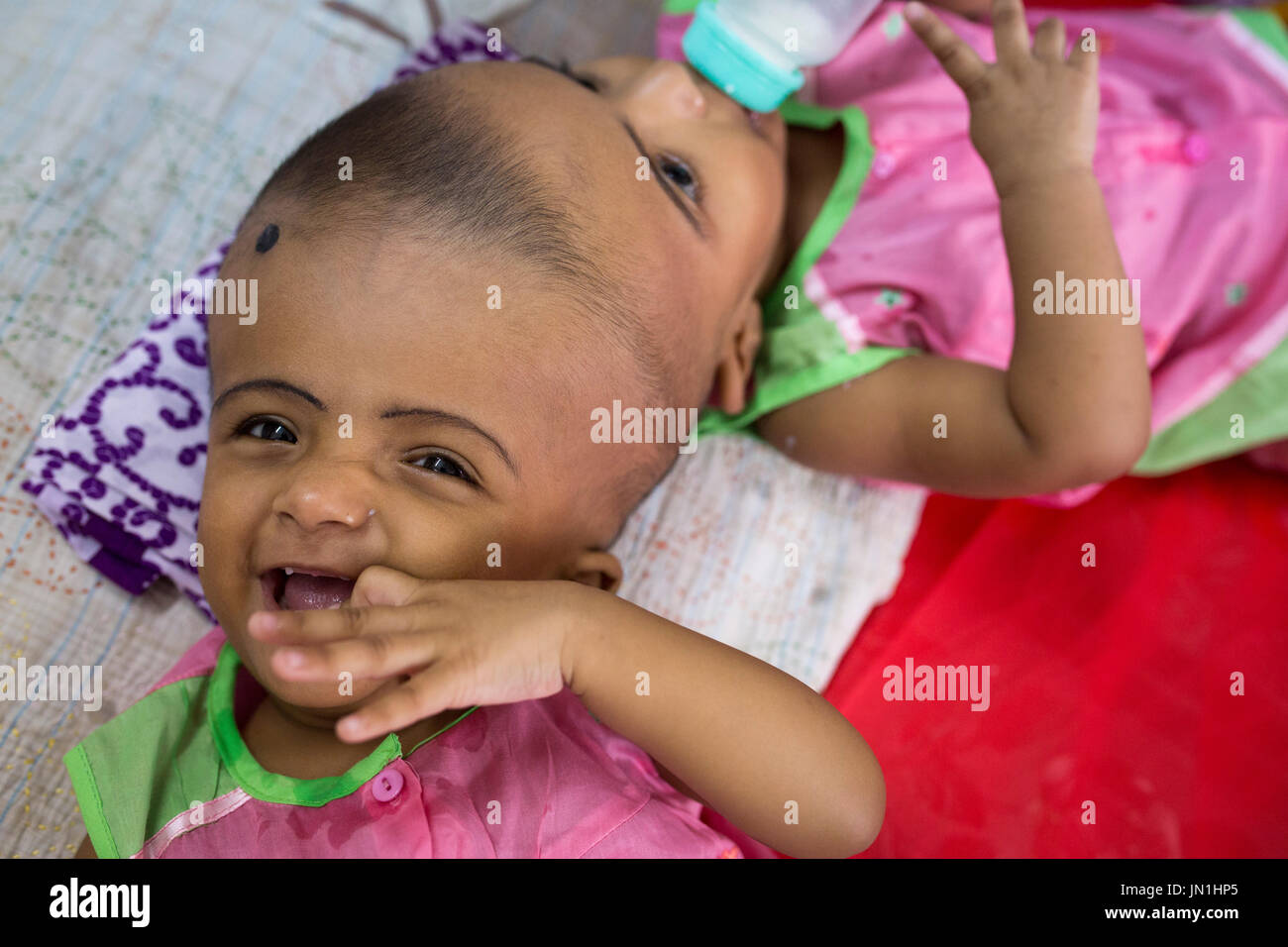 Dhaka, Bangladesh. 29 juillet, 2017. DHAKA, BANGLADESH - 29 juillet : lits jumeaux siamois filles Rabeya l'Islam et l'Islam Rokeya jouer dans un hôpital à Dhaka, Bangladesh, le 29 juillet 2017. Taslima Khatun, professeur d'école, a donné une naissance de jumeaux siamois le dirigé le 16 juillet 2016 après une césarienne. Les jumeaux ont été admis à un hôpital du gouvernement pour examen avant la chirurgie potentiellement à séparer leurs têtes. Zakir Hossain Chowdhury Crédit : zakir/Alamy Live News Banque D'Images