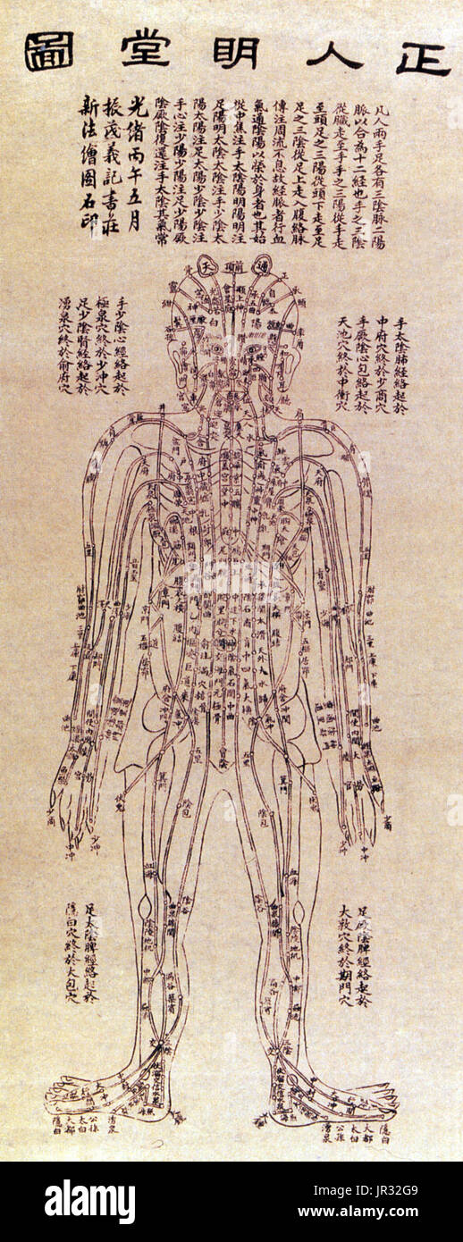L'acuponcture chinoise graphique,1906 Banque D'Images