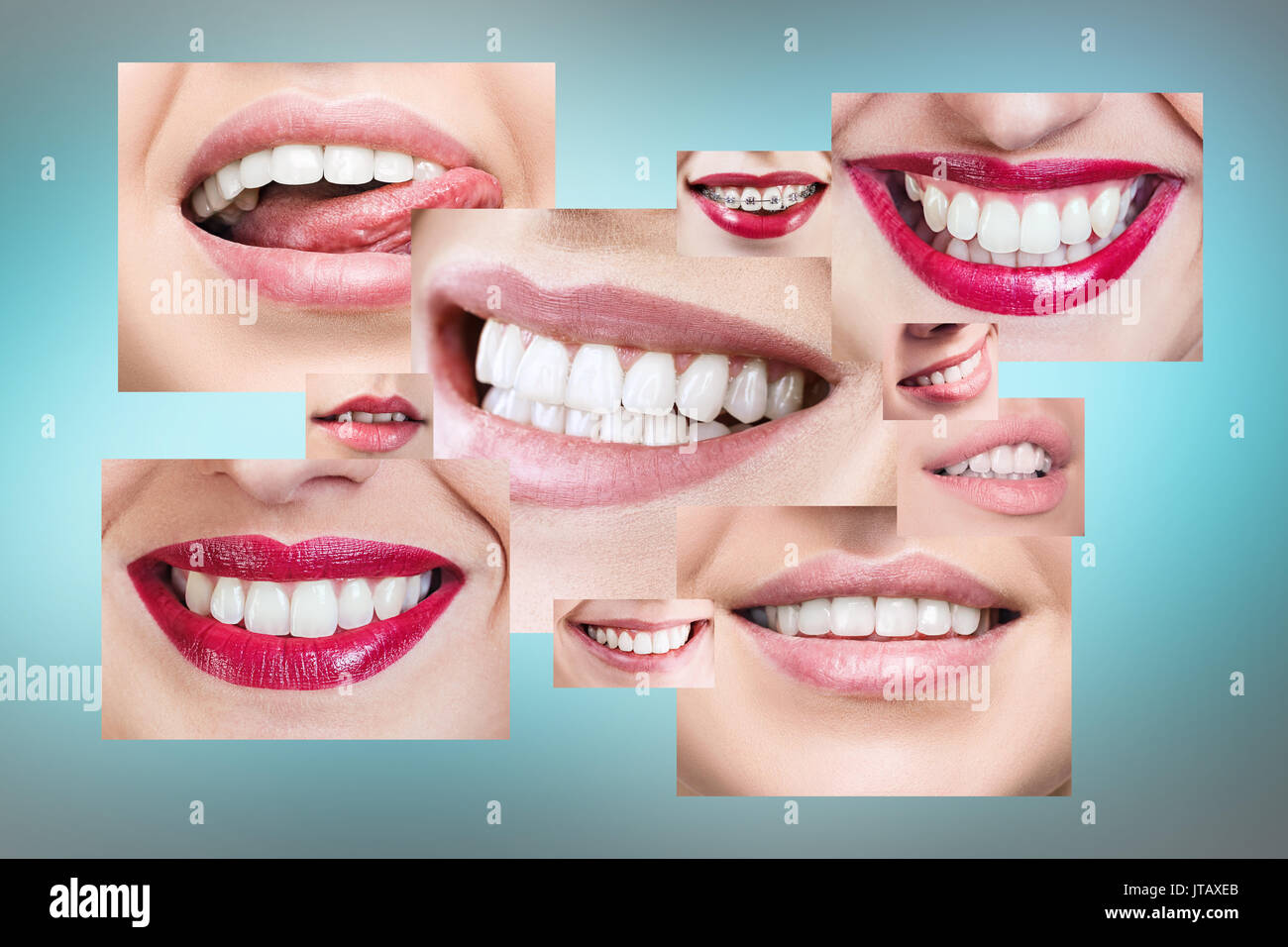 Collage d'une saine smiling people. Le concept de la santé dentaire. Sur fond bleu. Banque D'Images