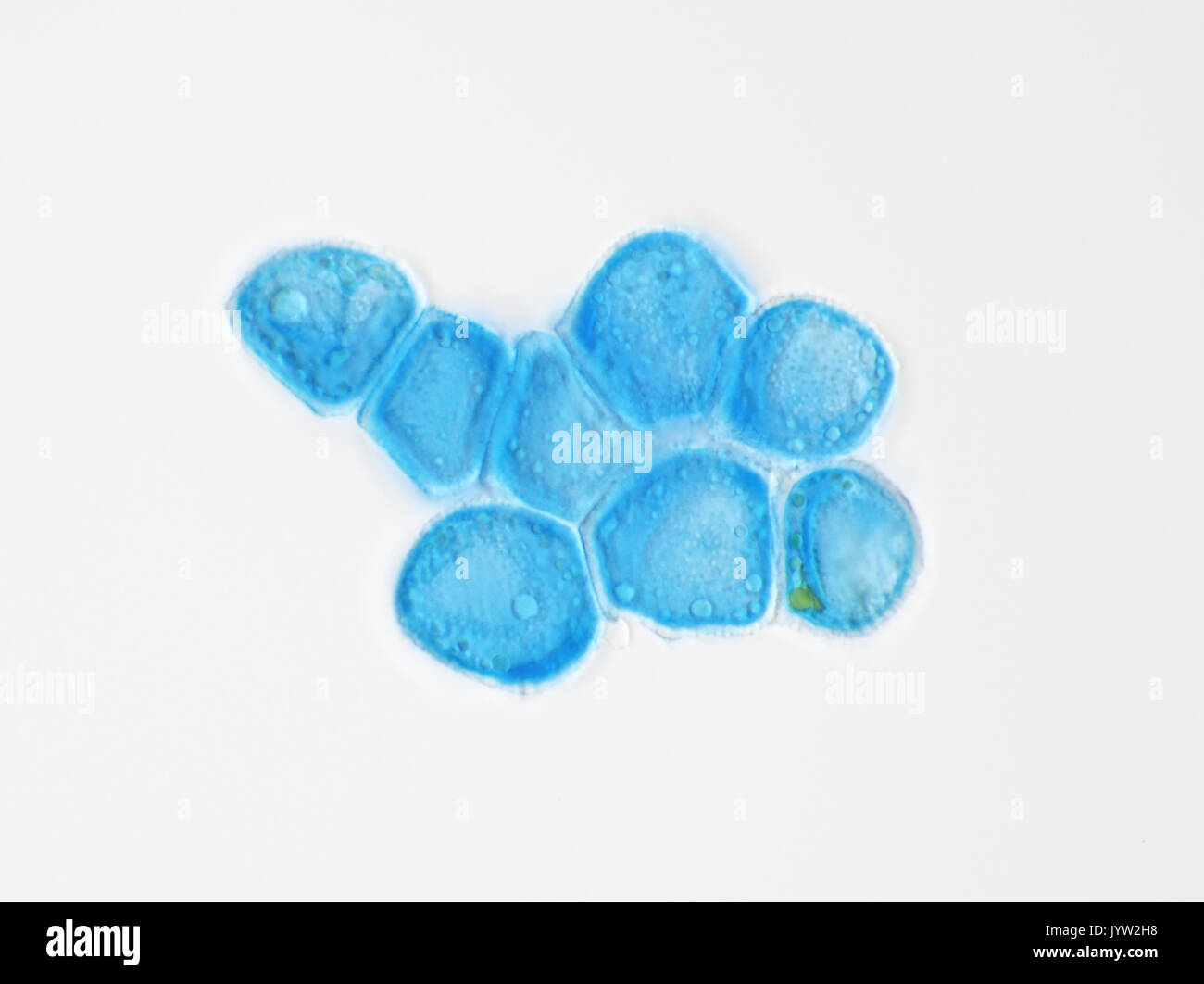 Micrographie de lumière bleu méthyl-rouille taché (Gymnosporangium sp.), la taille de chaque cellule ~20 microns Banque D'Images