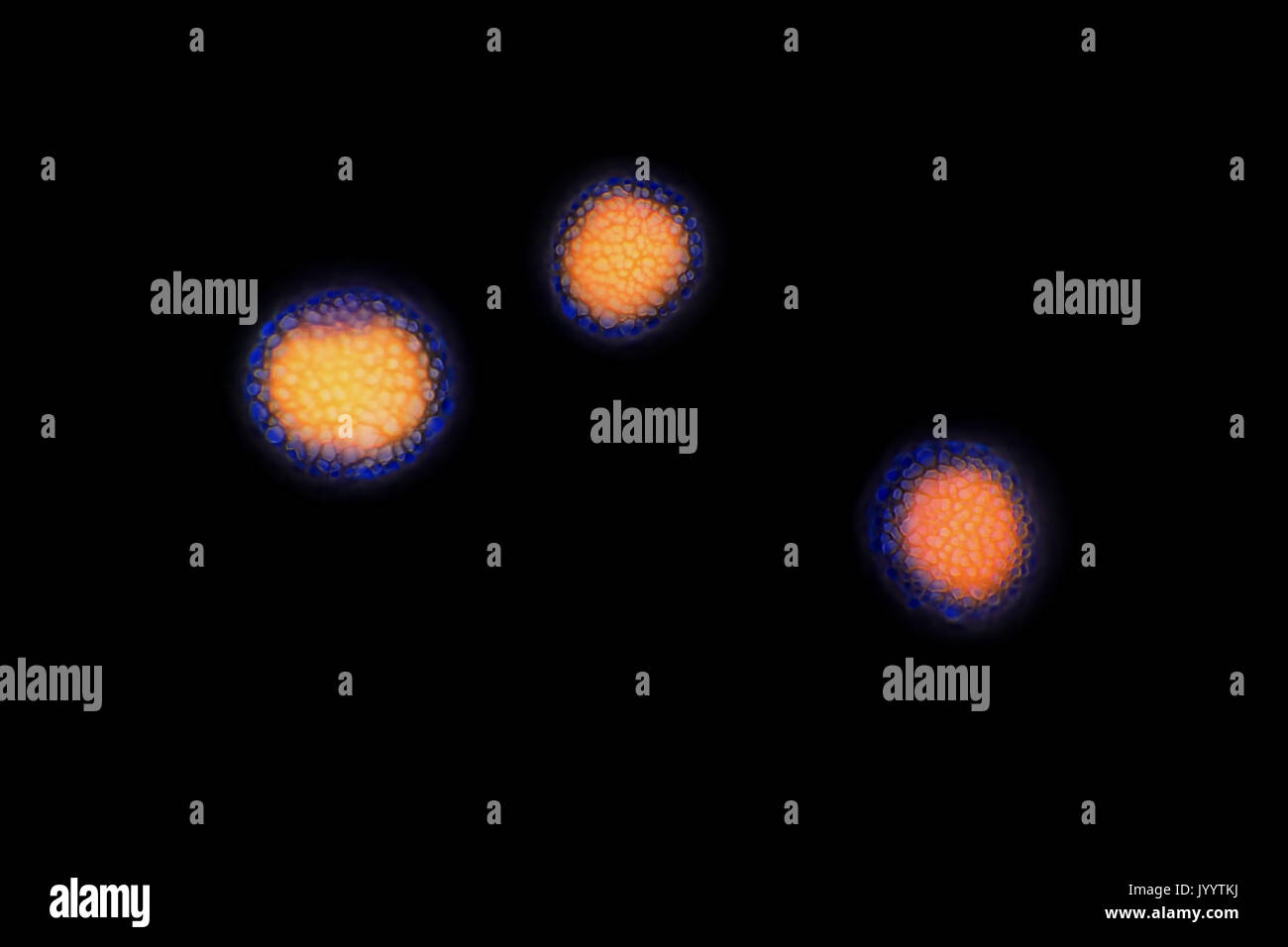 Grains de pollen (spores) à partir d'un échantillon d'air, tachés de bleu de méthyle, l'inversion de champ lumineux light micrograph, la taille de chaque particule ~17-22 micromètres Banque D'Images