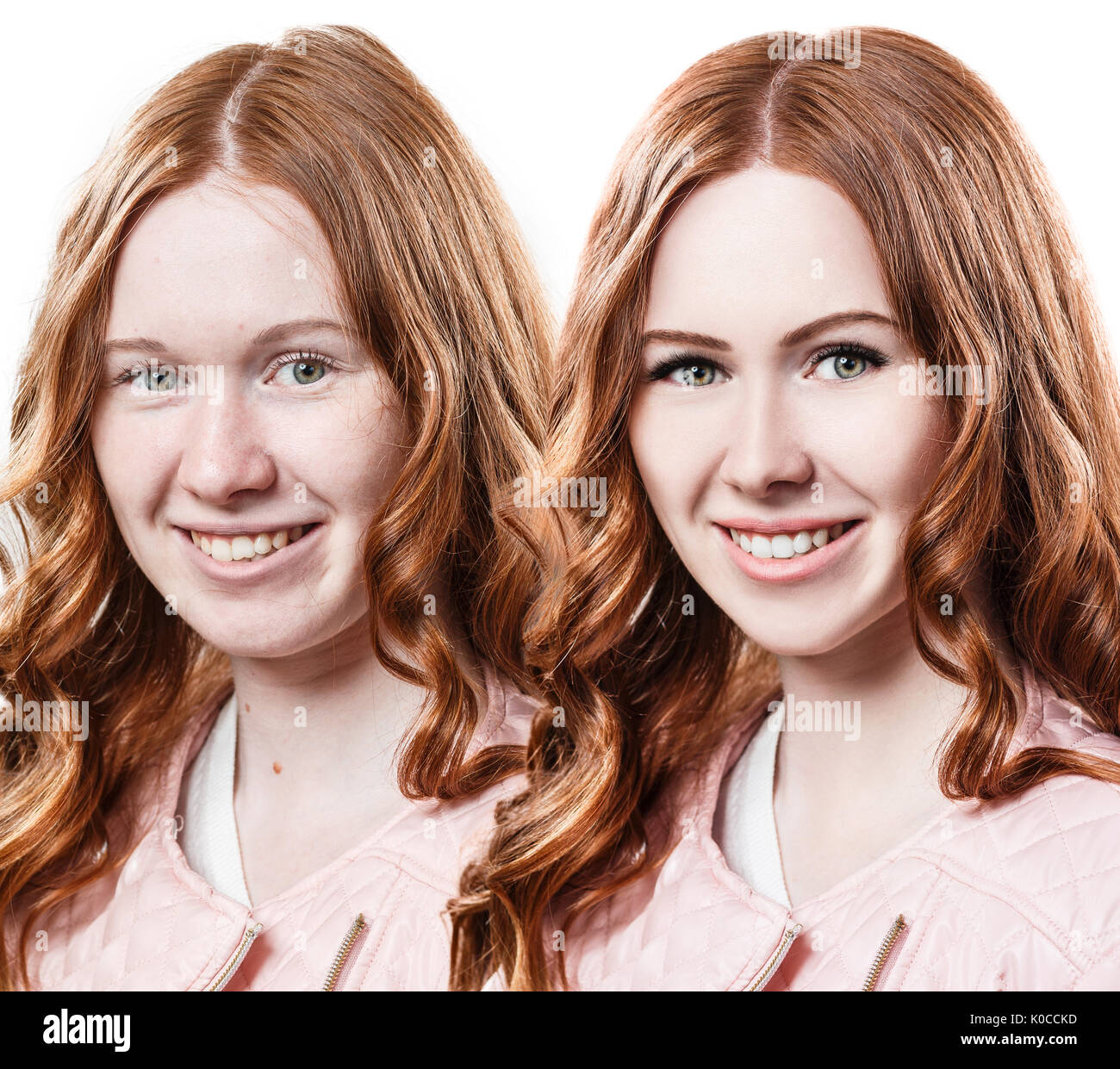 Redhead girl avant et après avoir repiqué. Banque D'Images