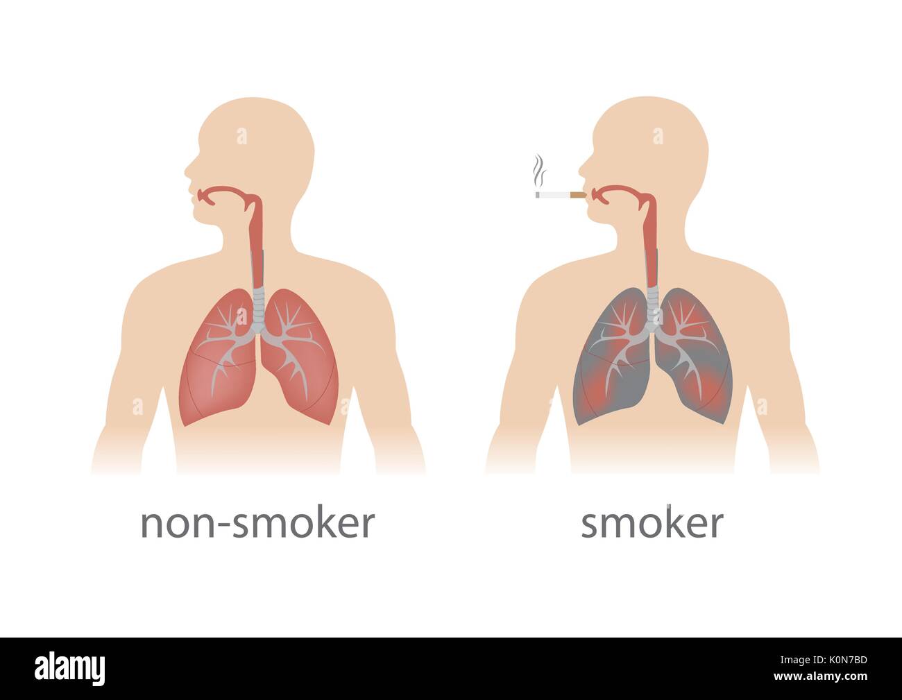 Fumeur Et Non Fumeur Poumons Comparaison Format Vectoriel Image Vectorielle Stock Alamy Fumeur Et Non Fumeur Poumons Comparaison Format Vectoriel Image Vectorielle Stock Alamy