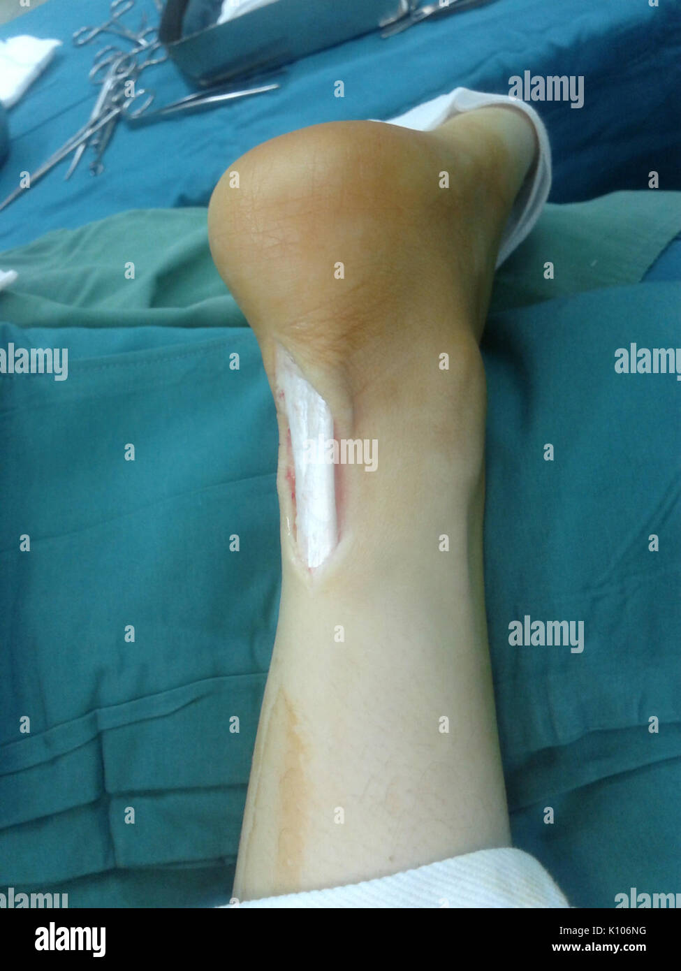 Le tendon d'achille 01 Banque D'Images