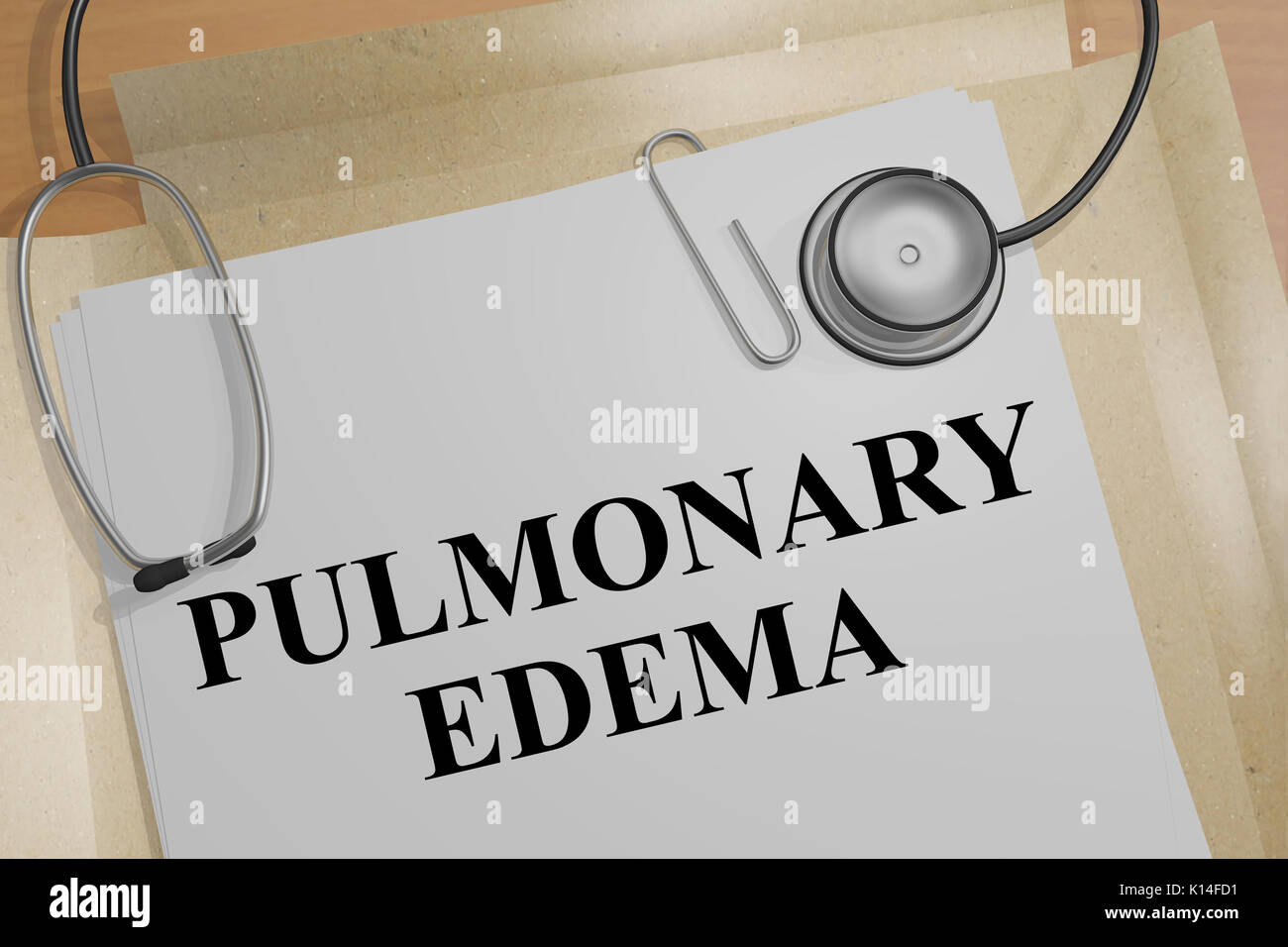 3D illustration de 'ŒDÈME PULMONAIRE' titre sur un document médical Banque D'Images