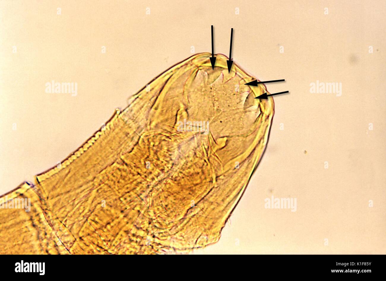 Cette microphotographie non colorées révèle l'Ancylostoma duodenale la bouche de l'ankylostome, pièces Mag. 125X. L'ankylostomiase utilise ces dents affûtés à saisir solidement à la paroi intestinale, et tout en restant arrimé, aspire le sang de l ?hôte, d'obtenir ses nutriments de cette façon. Image courtoisie CDC/Dr. Mae Melvin, 1982. Banque D'Images