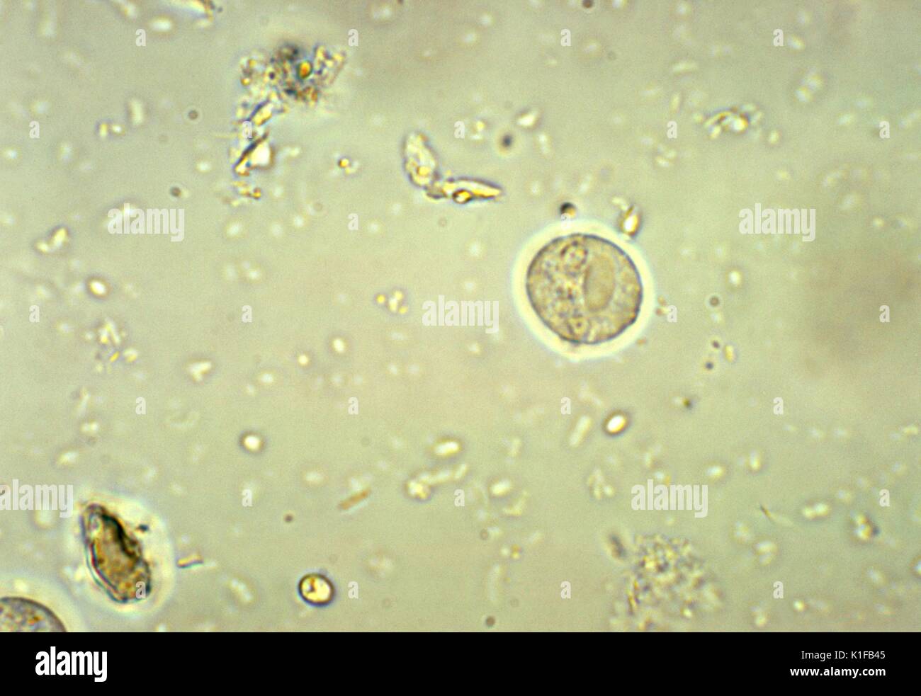 Cette microphotographie non colorées a révélé la morphologie ultrastructurale exposées par un parasite Entamoeba histolytica kyste. Caractéristiques incluses deux noyaux, et un objet contondant à tous chromatoid body. Entamoeba histolytica mature 4 kystes des noyaux qui ont typiquement karyosomes situé de manière centrale et d'amende, une répartition uniforme de la chromatine périphérique. Kystes mesurent habituellement 12 à 15 {}m micro. Image courtoisie CDC/Dr. Mae Melvin, 1977. Banque D'Images