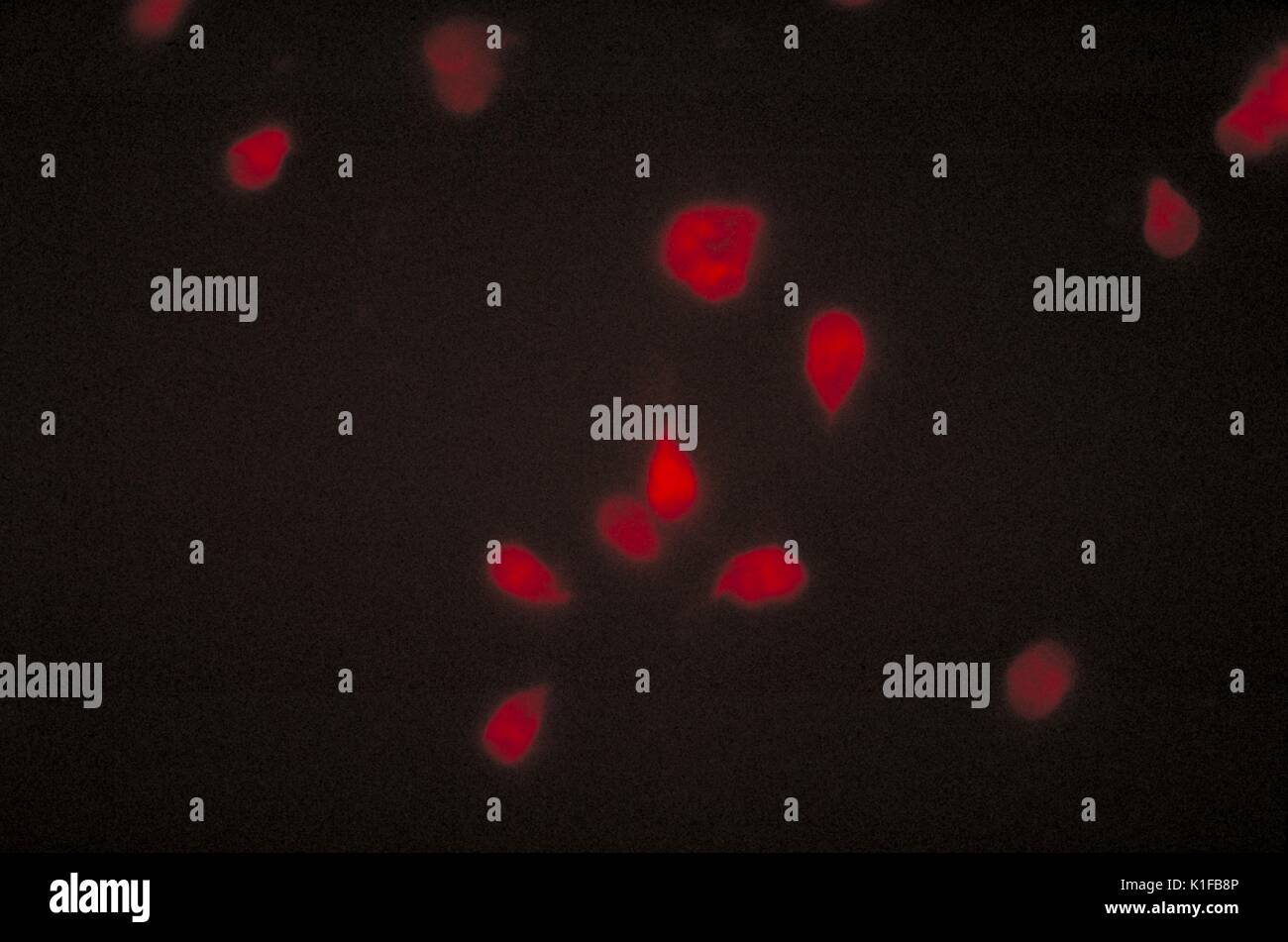 Cette microphotographie montre un effet négatif d'immunofluorescence indirecte (IFA) test de parasites Giardia lamblia. Image courtoisie CDC/Dr. Govinda S. Visvesvara, 1978. Banque D'Images