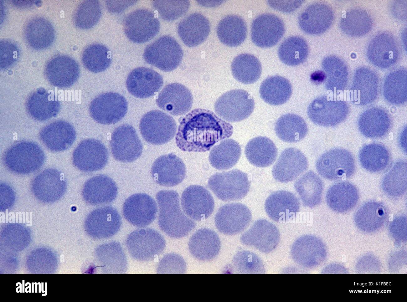 Frottis sanguin montrant de Plasmodium vivax trophozoïte croissante . Parasite. Image courtoisie CDC/Dr. Mae Melvin. 1981. Banque D'Images