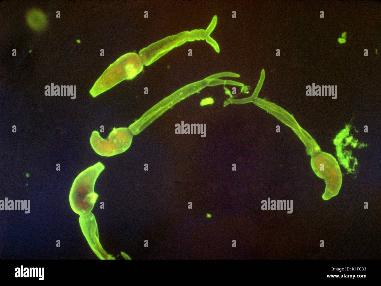 Les cercaires de Schistosoma mansoni . L'immunofluorescence indirecte (IFA). Parasite. Image courtoisie CDC/Dr. Sulzer, 1963. Banque D'Images
