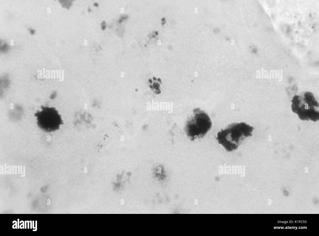 Les parasites du paludisme dans le sang. Schizonte mature, en forme de rosette. Certains du cytoplasme des mérozoïtes est visible sur le pigment agrégative. Image courtoisie CDC/Dr. N.J. Wheeler, Jr, 1963. Banque D'Images