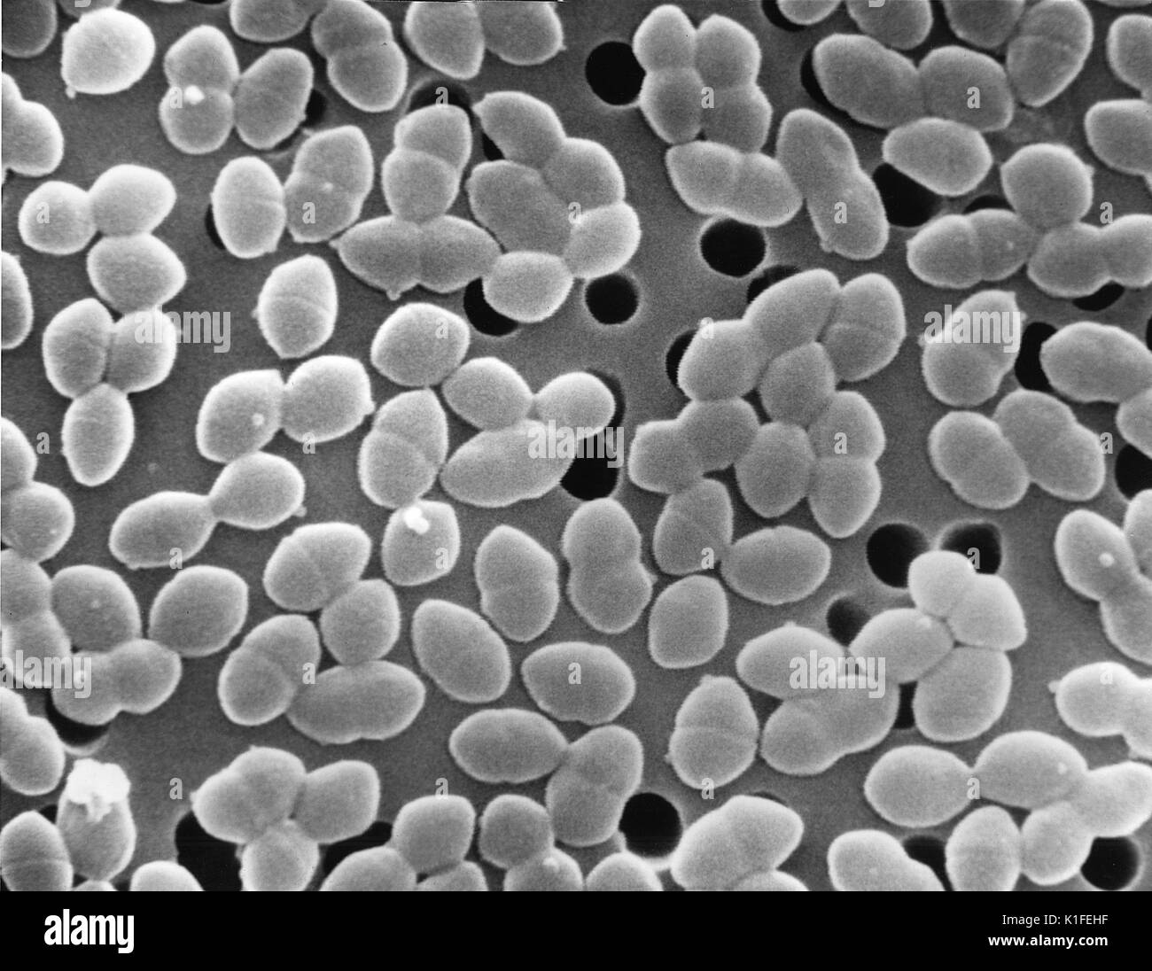 Cette micrographie électronique à balayage (MEB) représenté plus de bactéries, qui ont été identifiés comme étant des bactéries Gram-positives Enterococcus sp. des bactéries. Identifiés précédemment comme 'Groupe d' organismes Streptococcus, les plus pertinents sur le plan clinique de ces bactéries sont, E. faecalis et E. faecium . Les bactéries d'Enterococcus spp. sont notoirement lié agents étiologiques responsables d'infections nosocomiales, ou 'origine' l'hôpital des maladies, telles que 'les entérocoques résistants à la vancomycine, ou des infections à ERV. Ces organismes sont "dans la nature des commensaux, ce qui signifie qu'ils colonisent normalement le système digestif humain, et devenir pat Banque D'Images