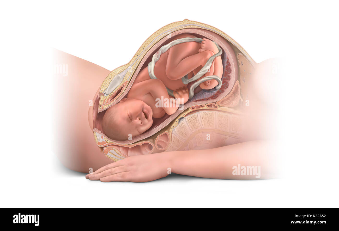 Le Bebe Est Expulse Lorsque Le Travail Est Suffisamment Dilate Le Col Pour Lui Permettre De Passer L Expulsion Facilite Par Les Contractions Uterines Et Les Contractions Abdominales Volontaire De La Mere Dure Le Bebe Est Expulse Lorsque Le Travail Est Suffisamment Dilate Le Col Pour Lui Permettre De Passer L Expulsion Facilite Par Les Contractions Uterines Et Les Contractions Abdominales Volontaire De La Mere Dure