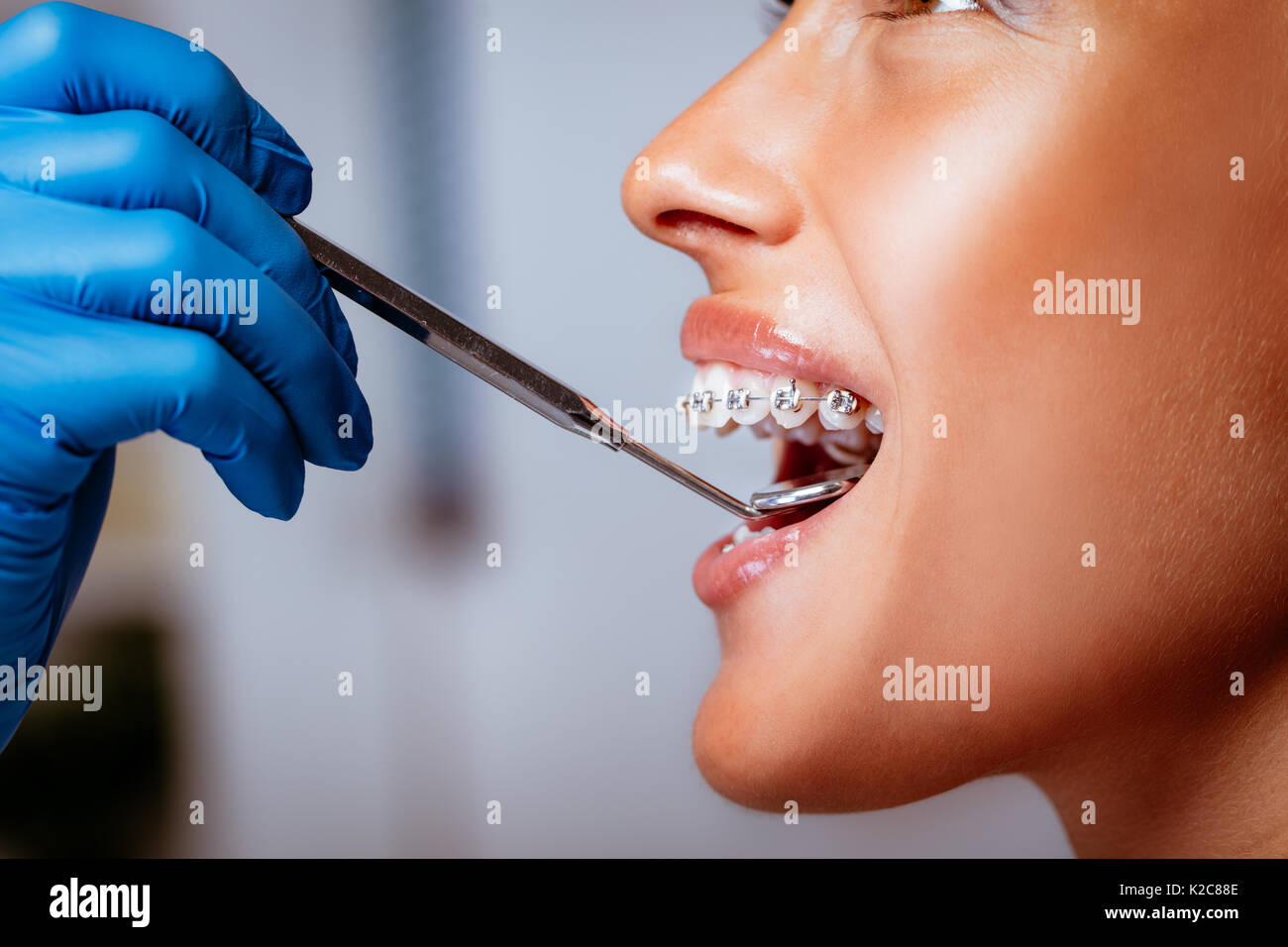 Close-up d'un dentiste contrôle accolades avec un miroir dentaire sur la  jeune patiente Photo Stock - Alamy