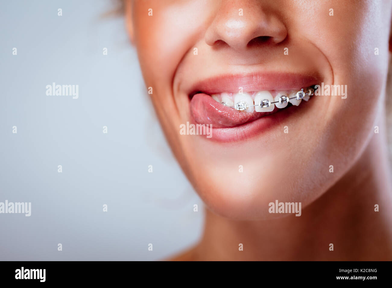 Close-up of a smiling girl face avec accolades de mordre la langue avec les dents parfaites. Banque D'Images