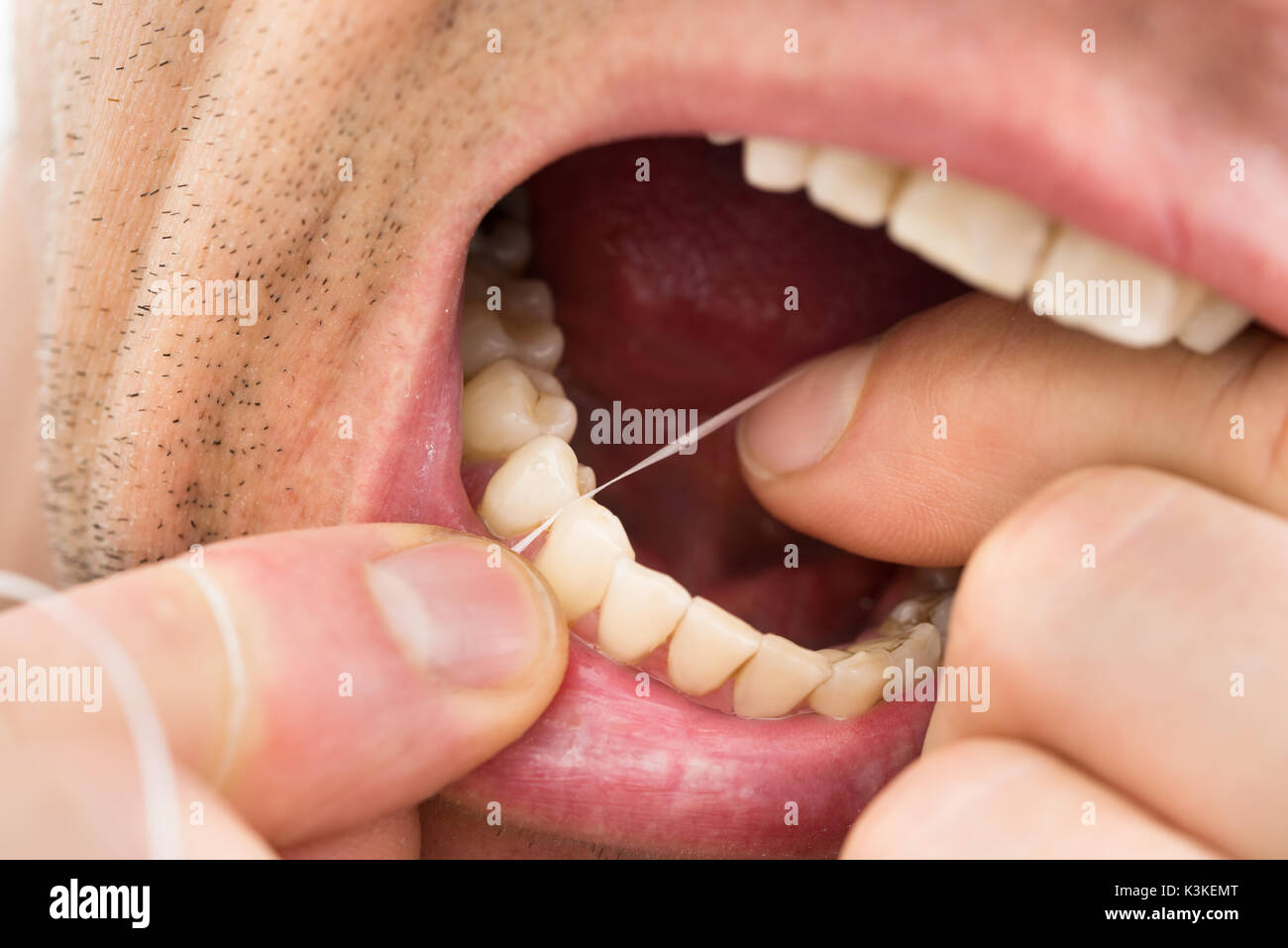 Photo en gros plan d'un homme de la soie dentaire dents Banque D'Images