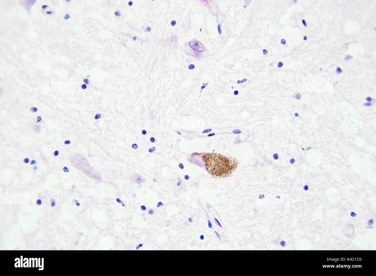 Les tissus du cerveau vue microscopique agrandissement x400 Banque D'Images