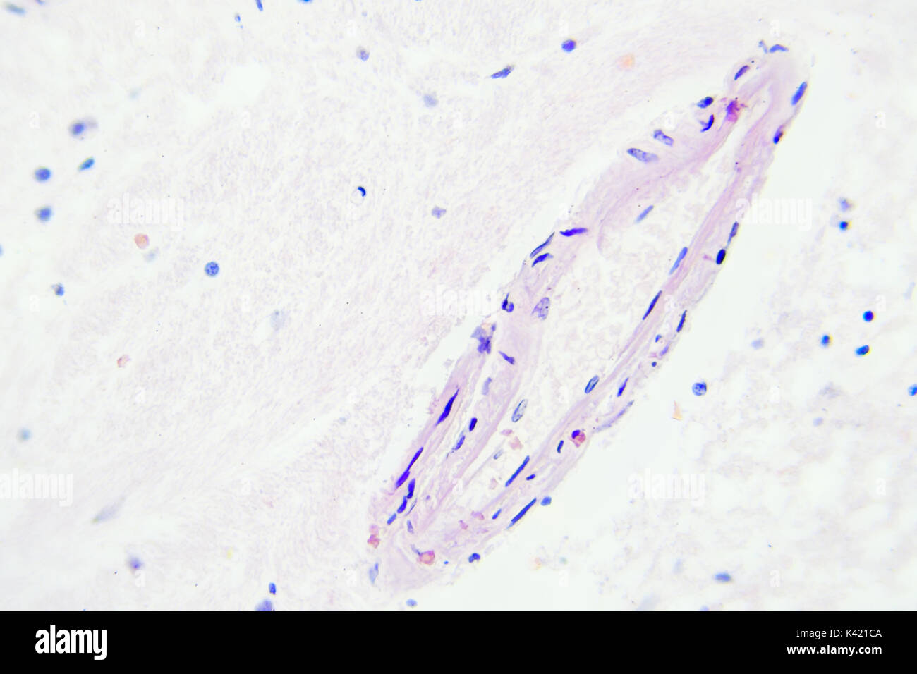 Les tissus du cerveau vue microscopique agrandissement x400 Banque D'Images