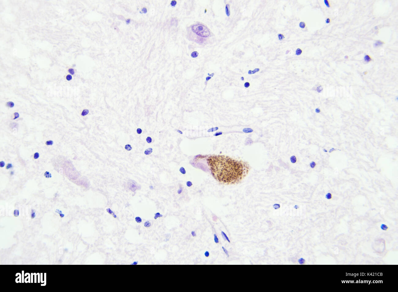 Les tissus du cerveau vue microscopique agrandissement x400 Banque D'Images