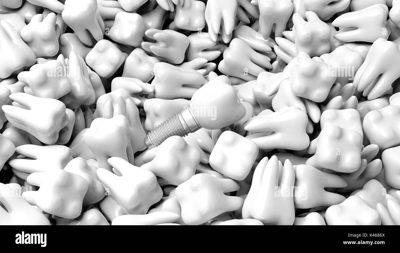 Implant dentaire sur les dents arrière-plan. 3d illustration Banque D'Images