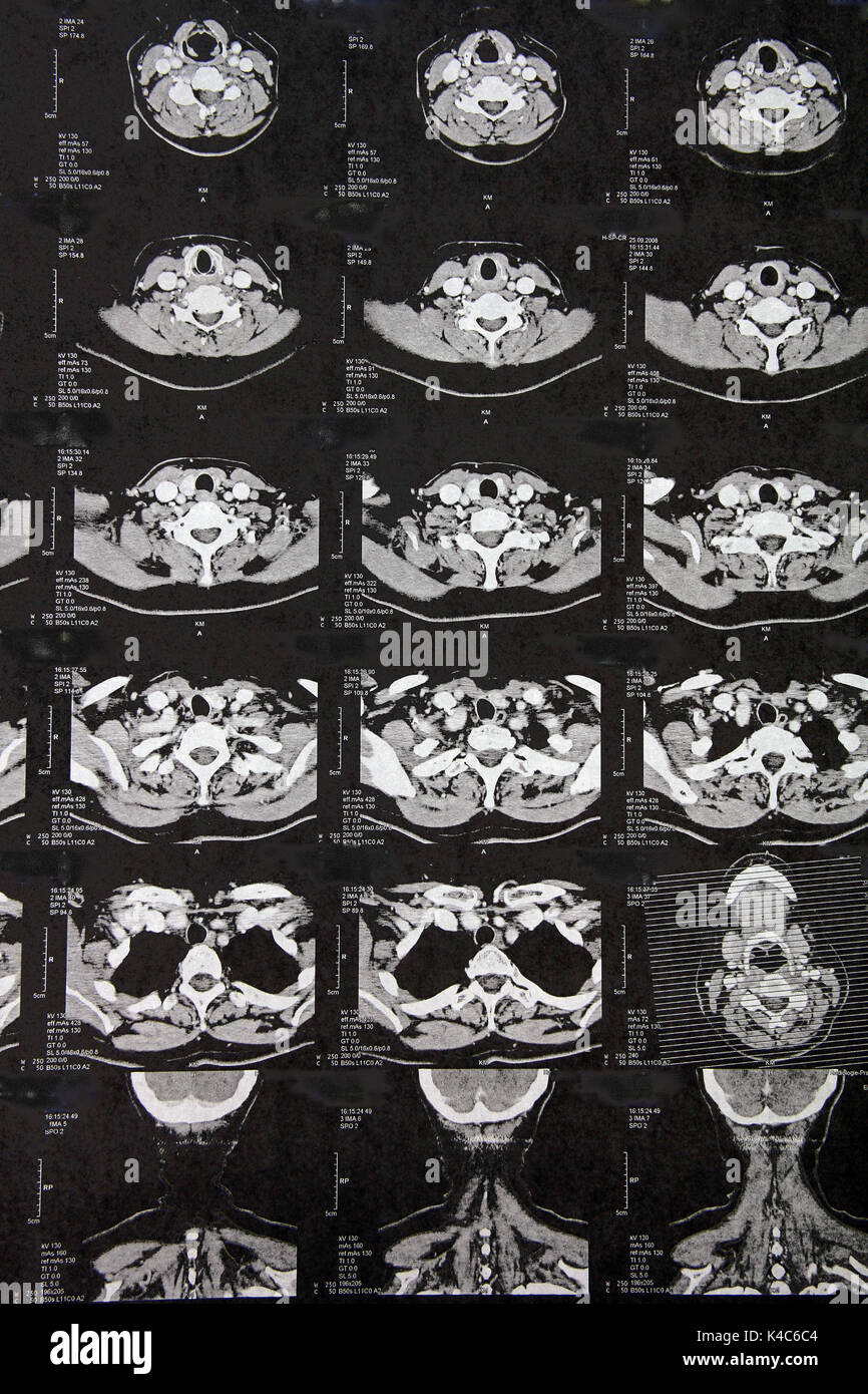 Examen radiologique Banque D'Images