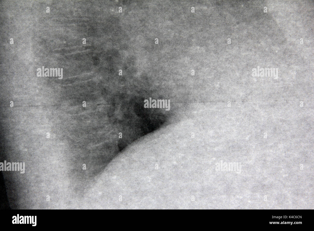 X-ray image d'un poumon mâle Banque D'Images