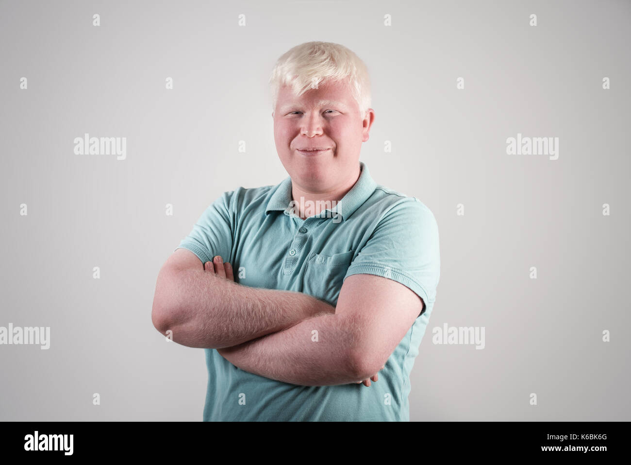 Albino albinism blond Banque de photographies et d’images à haute ...