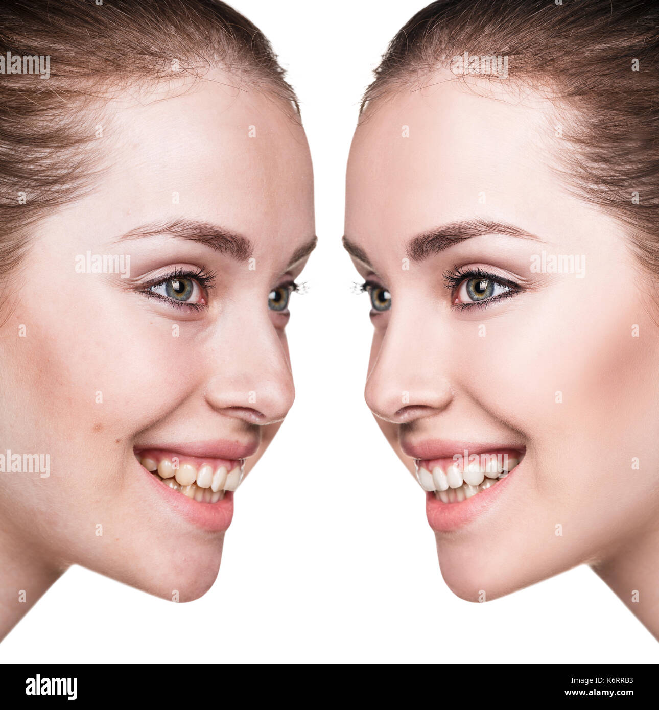 Portrait de jeune femme avant et après la retouche sur fond blanc. Banque D'Images