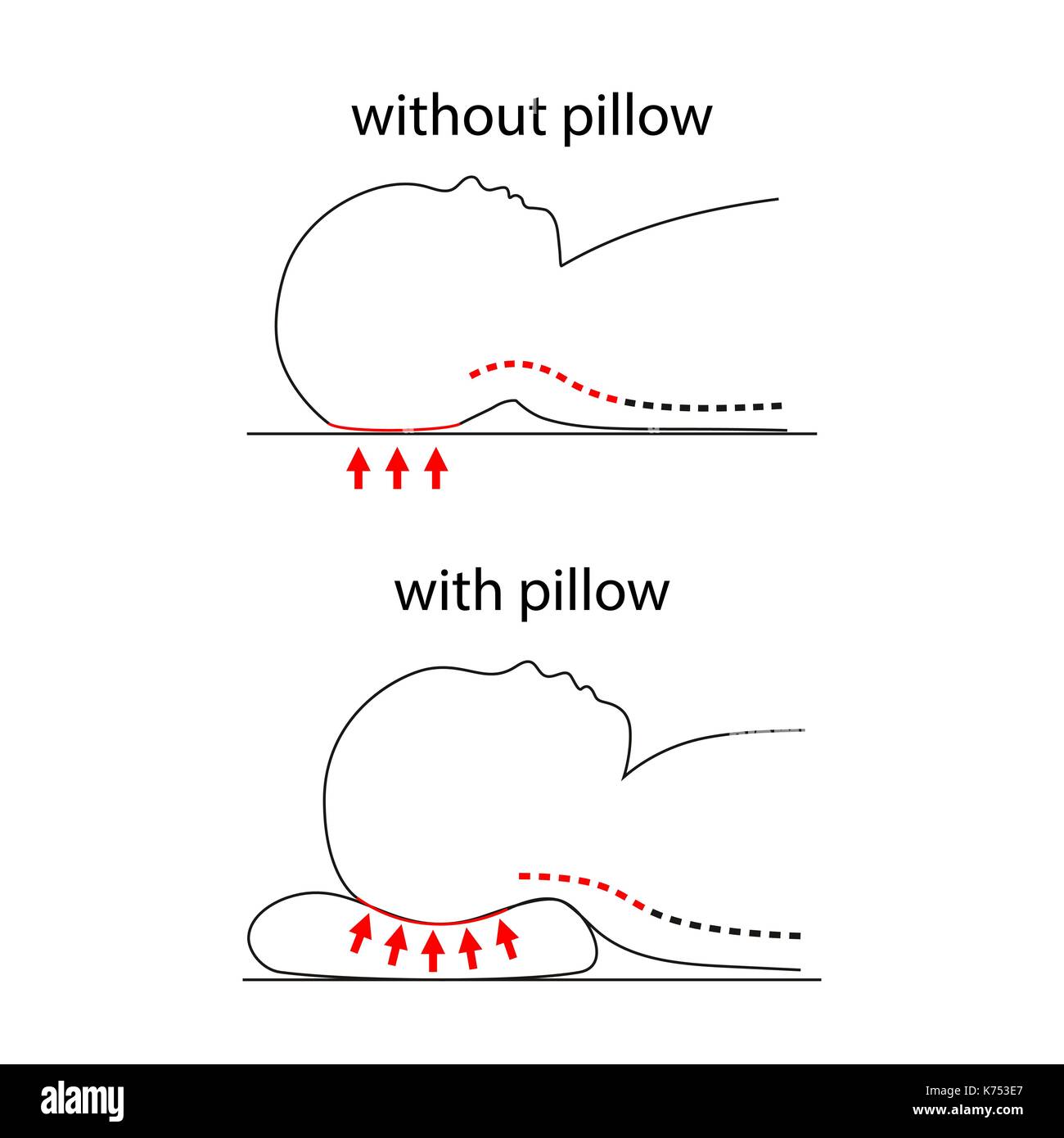 Illustration de la ligne de dos quand bébé dort sur un oreiller normal et sain oreiller. Illustration de Vecteur