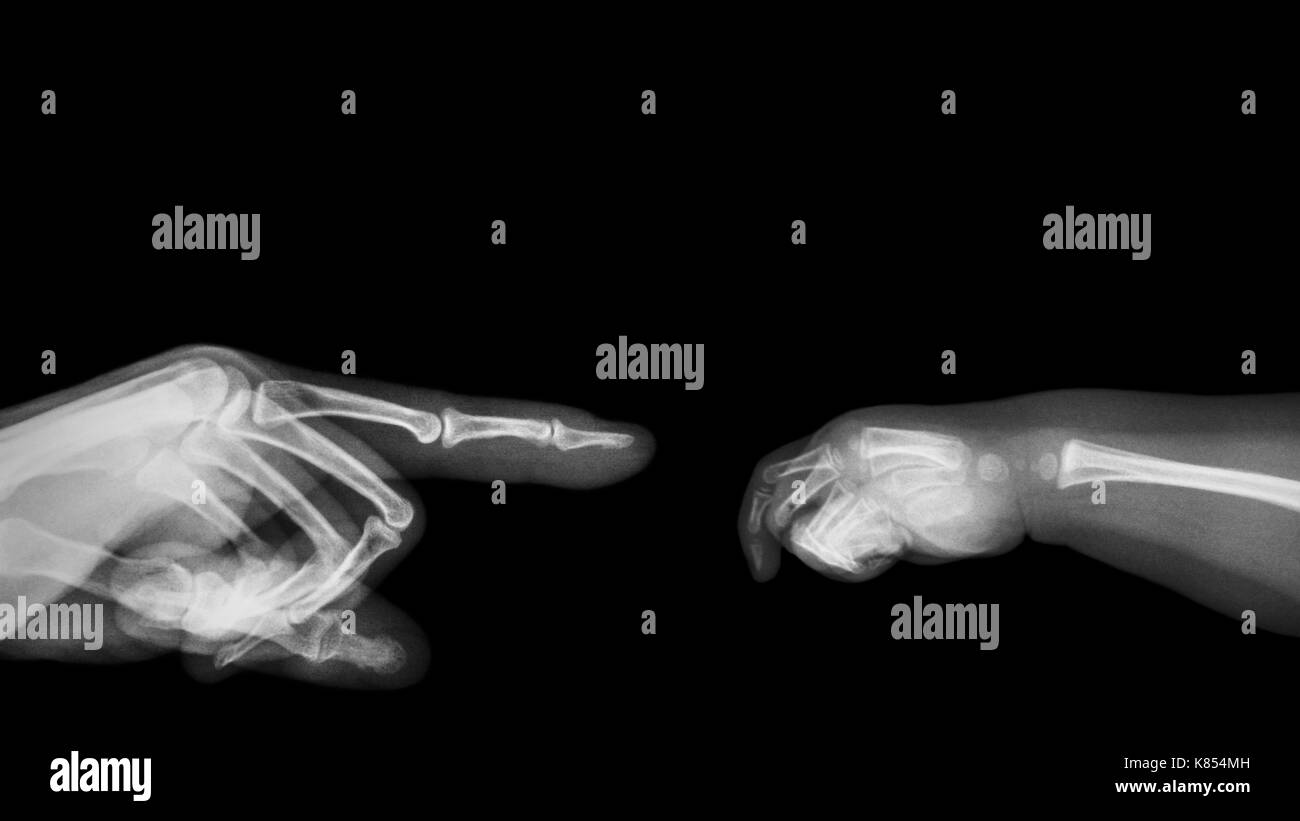 X-ray mains adultes pointer du doigt le côté gauche et de la main de bébé à droite. zone vide au côté supérieur . Banque D'Images