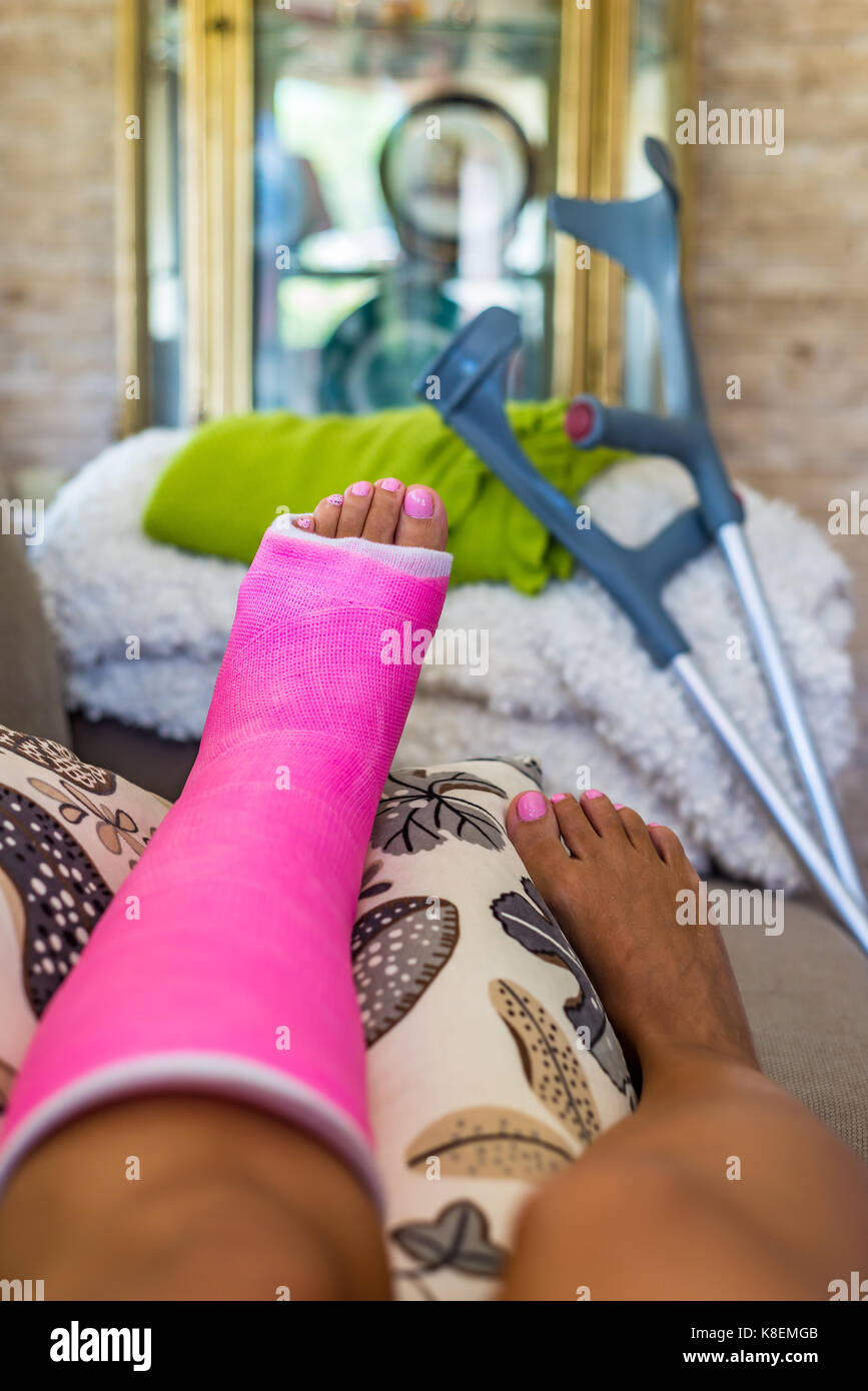 Femme avec jambe cassée jambe cassée en rose en plâtre reposant sur un coach Photo Stock Alamy