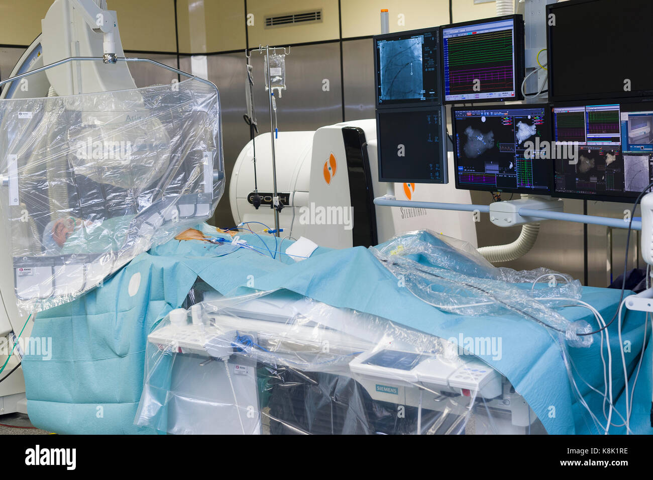 L'ablation par radiofréquence Banque D'Images