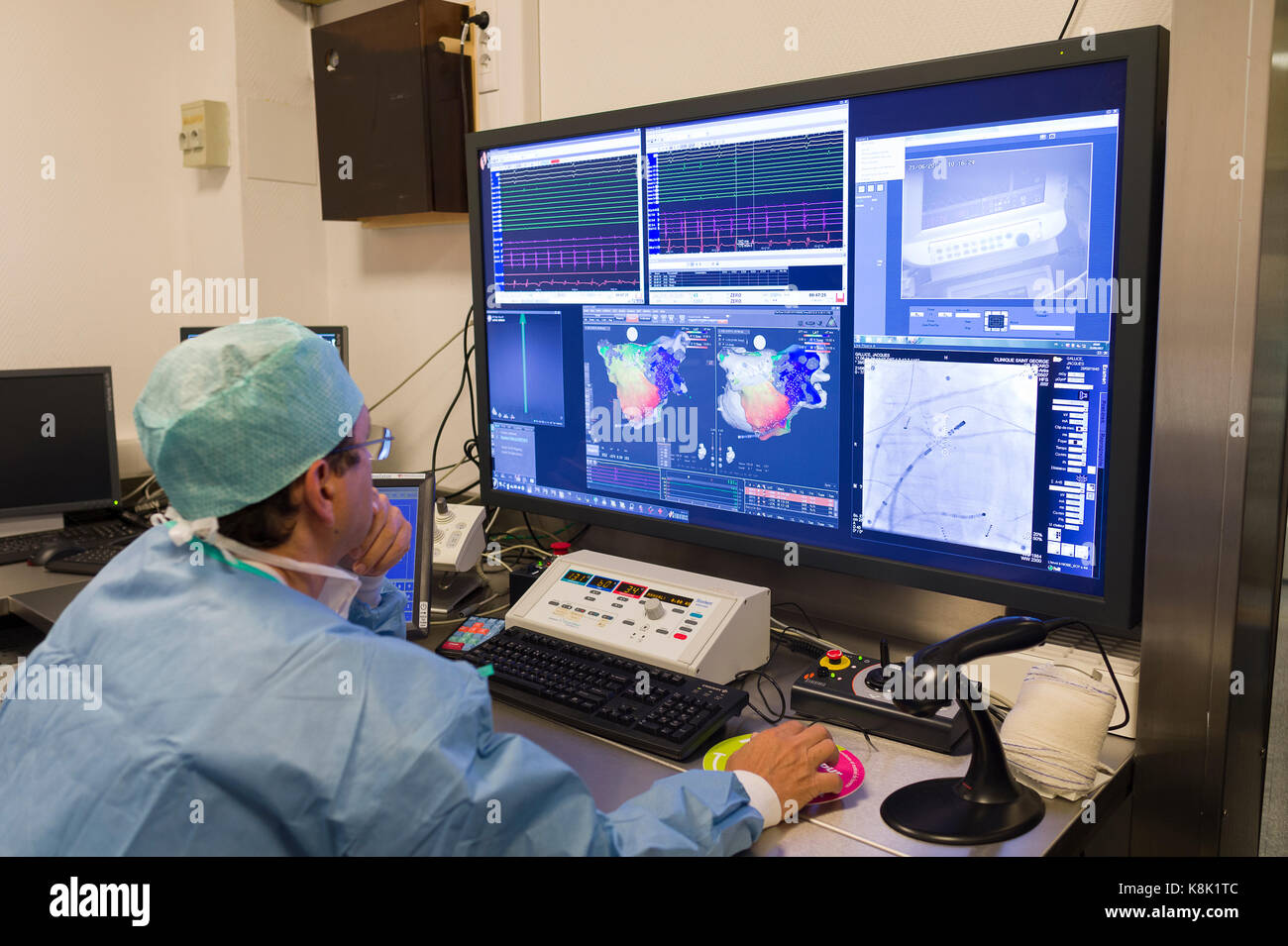 L'ablation par radiofréquence Banque D'Images