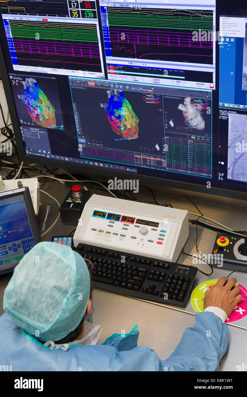 L'ablation par radiofréquence Banque D'Images