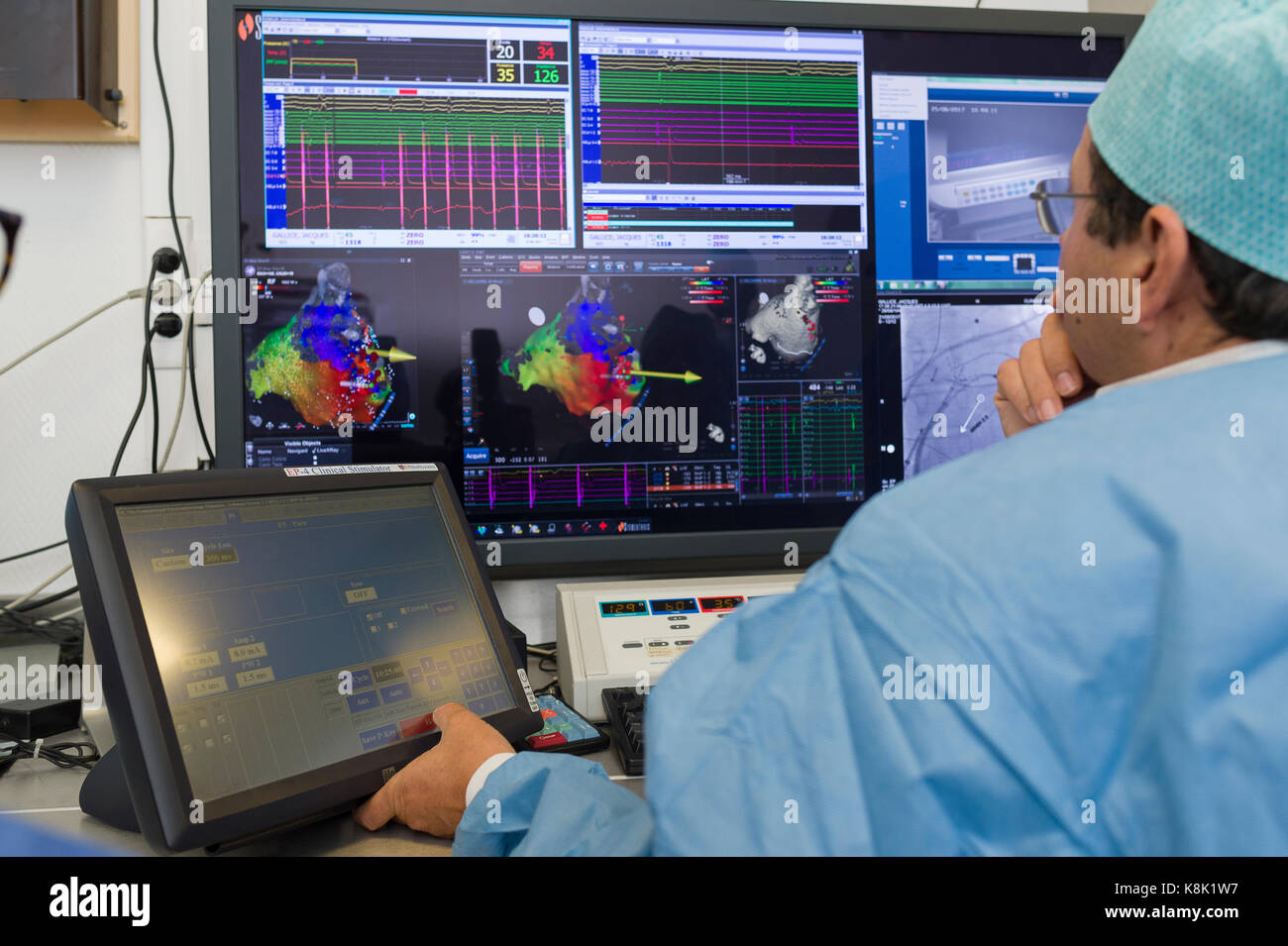 L'ablation par radiofréquence Banque D'Images