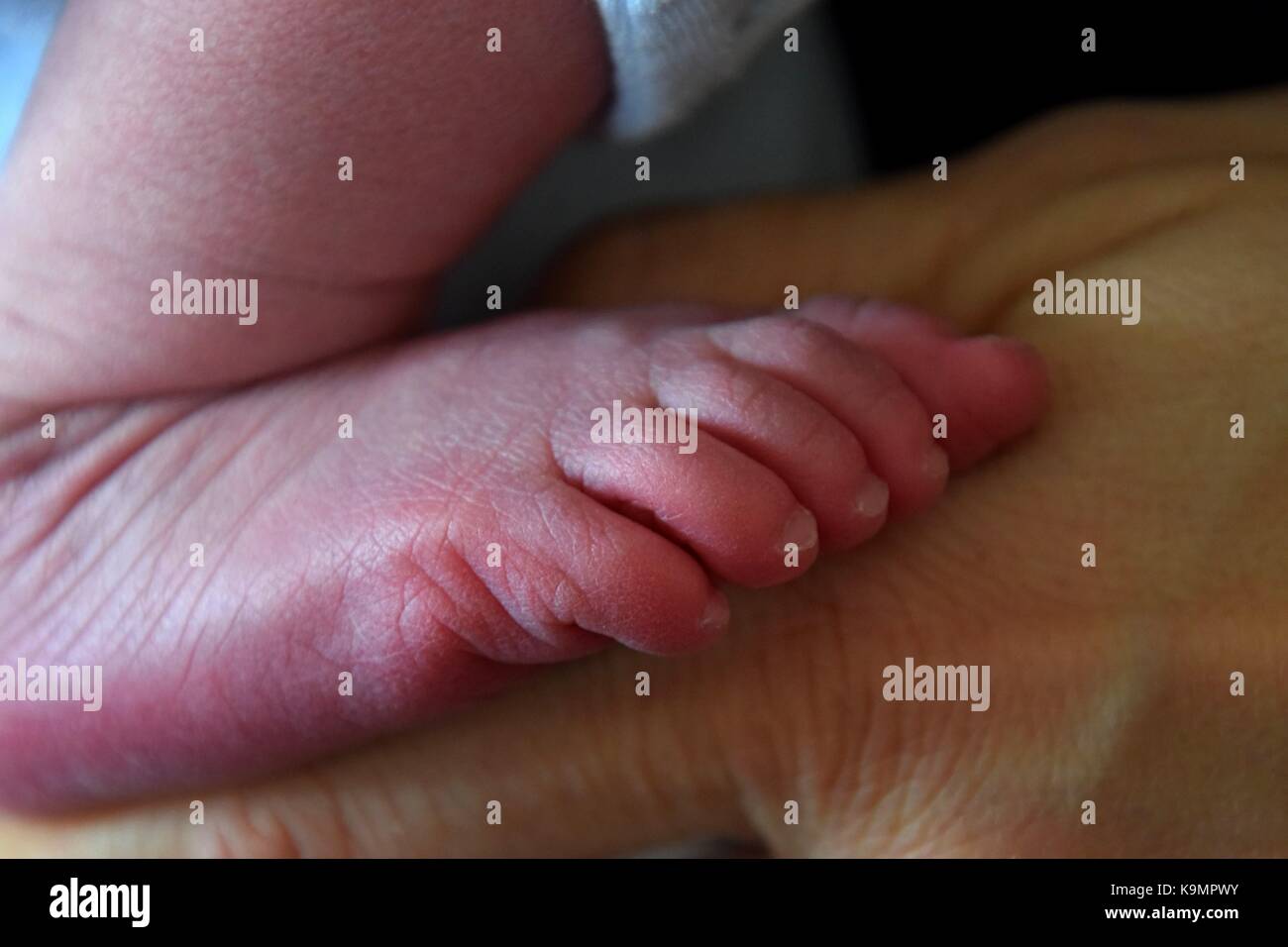 Lanugo Banque D Image Et Photos Alamy