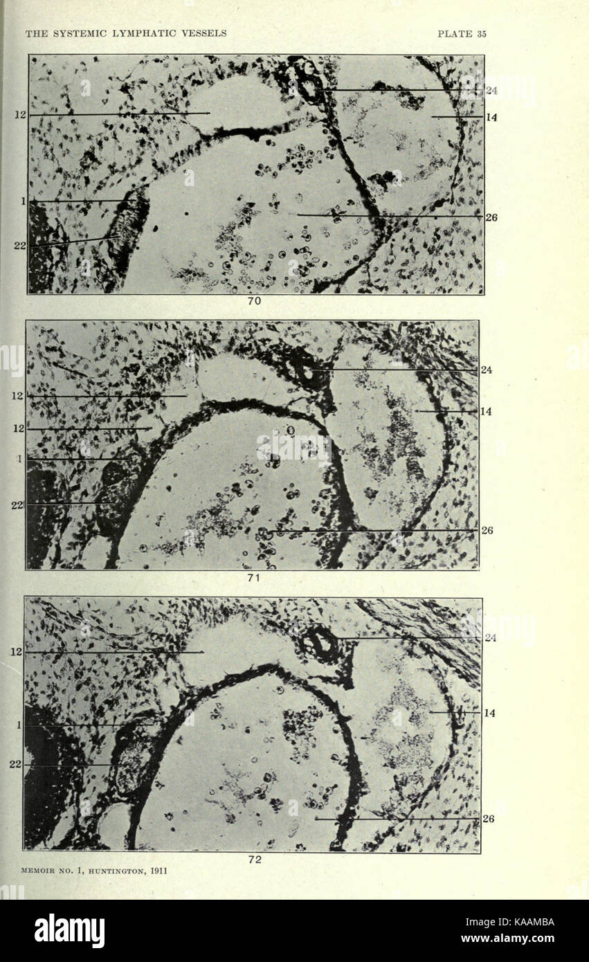 L'anatomie et le développement des vaisseaux lymphatiques systémique dans le chat domestique BHL23322356 Banque D'Images