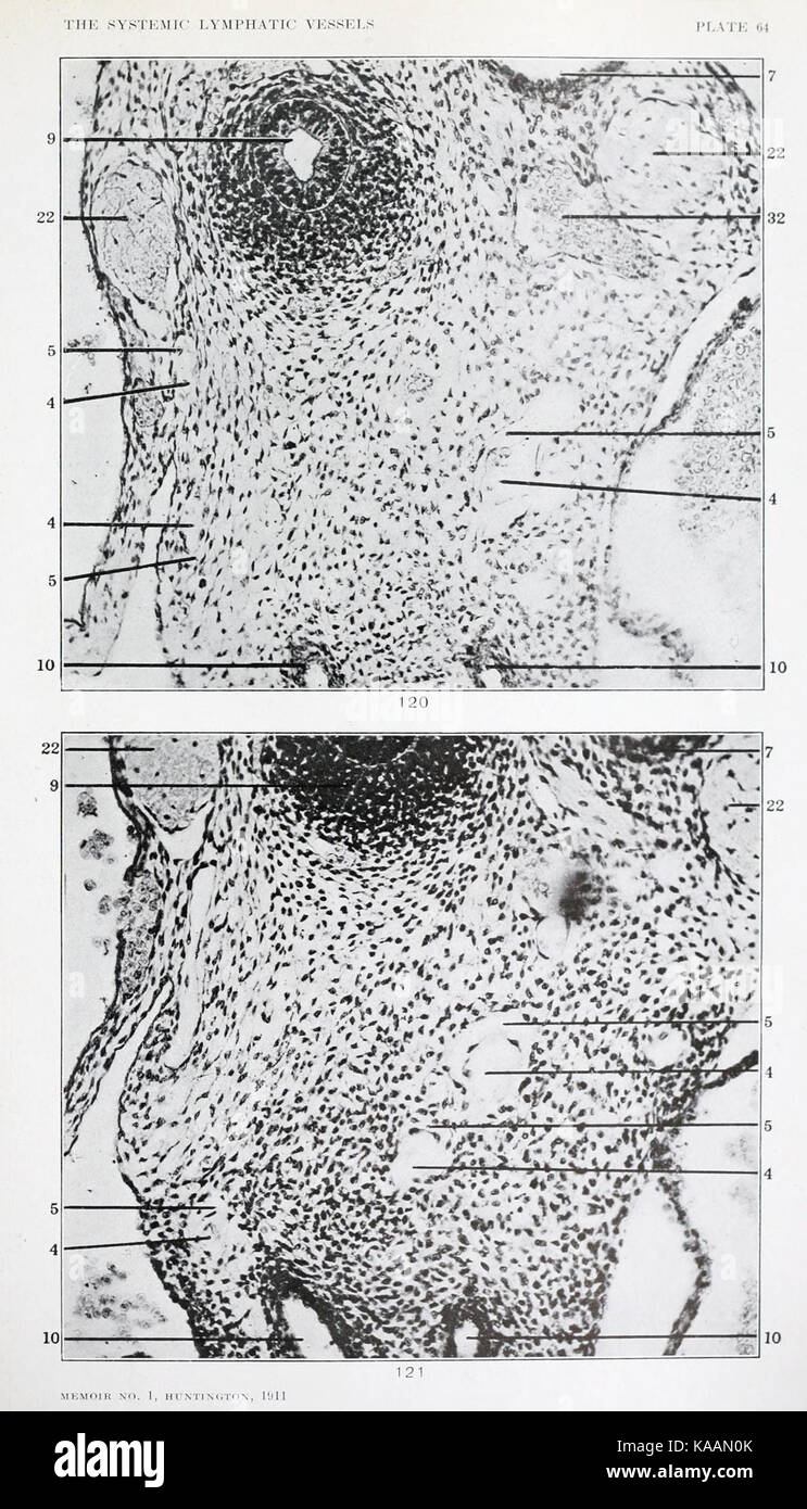 L'anatomie et le développement des vaisseaux lymphatiques systémique dans le chat domestique BHL21440437 Banque D'Images