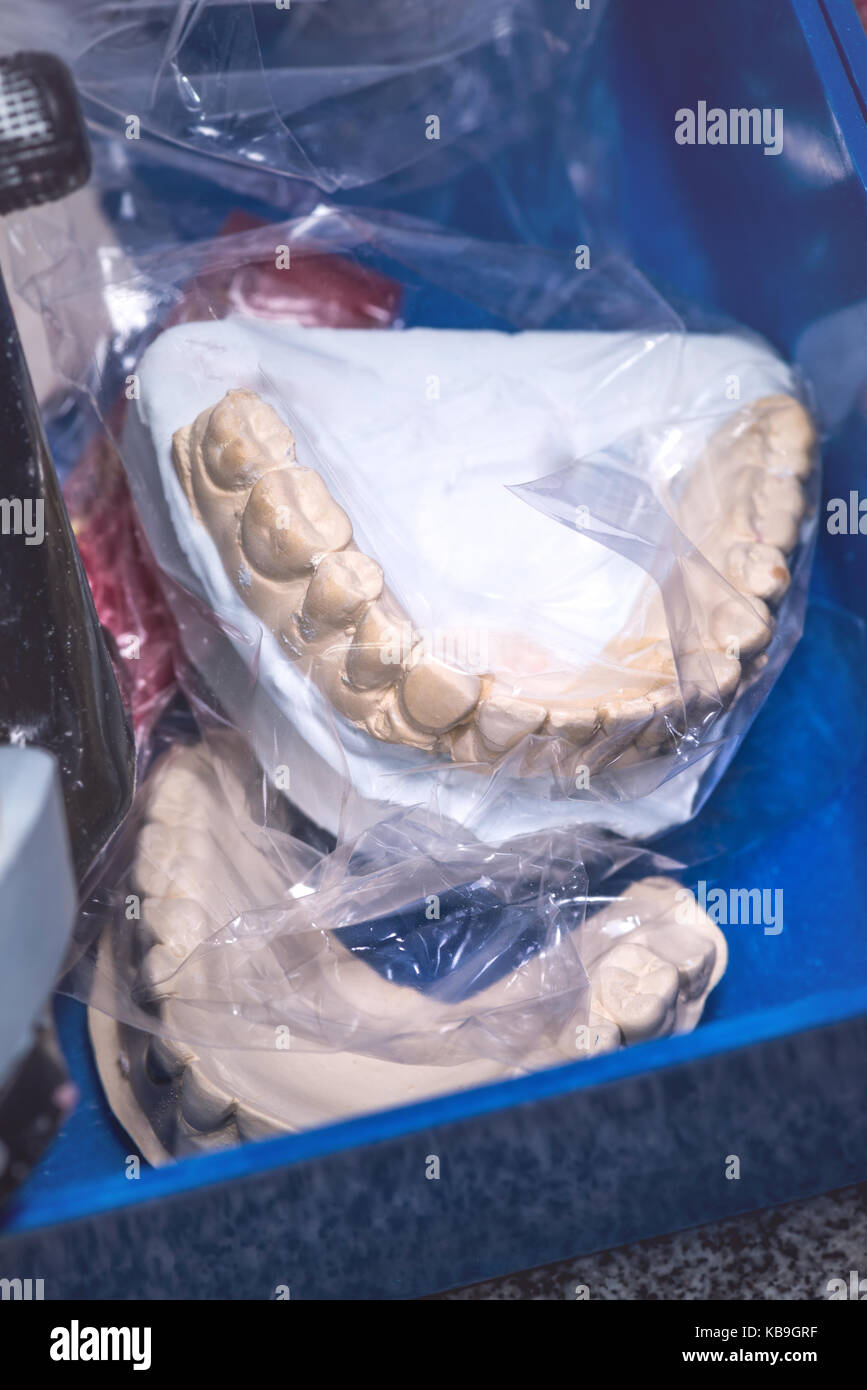 Prothèse dentaire, dent artificielle. photo de dents artificielles faites dans le laboratoire dentaire. Banque D'Images
