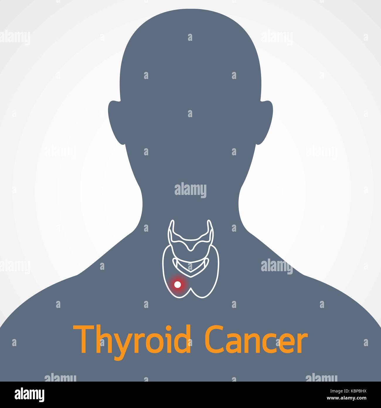 Le cancer de la thyroïde l'icône vector illustration Illustration de Vecteur