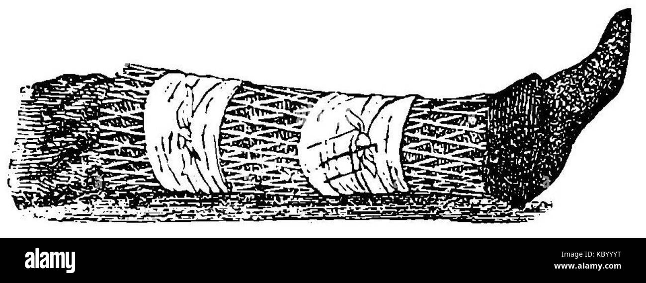 Grierson, 38a Entablillado cubremacetas de pierna con Banque D'Images