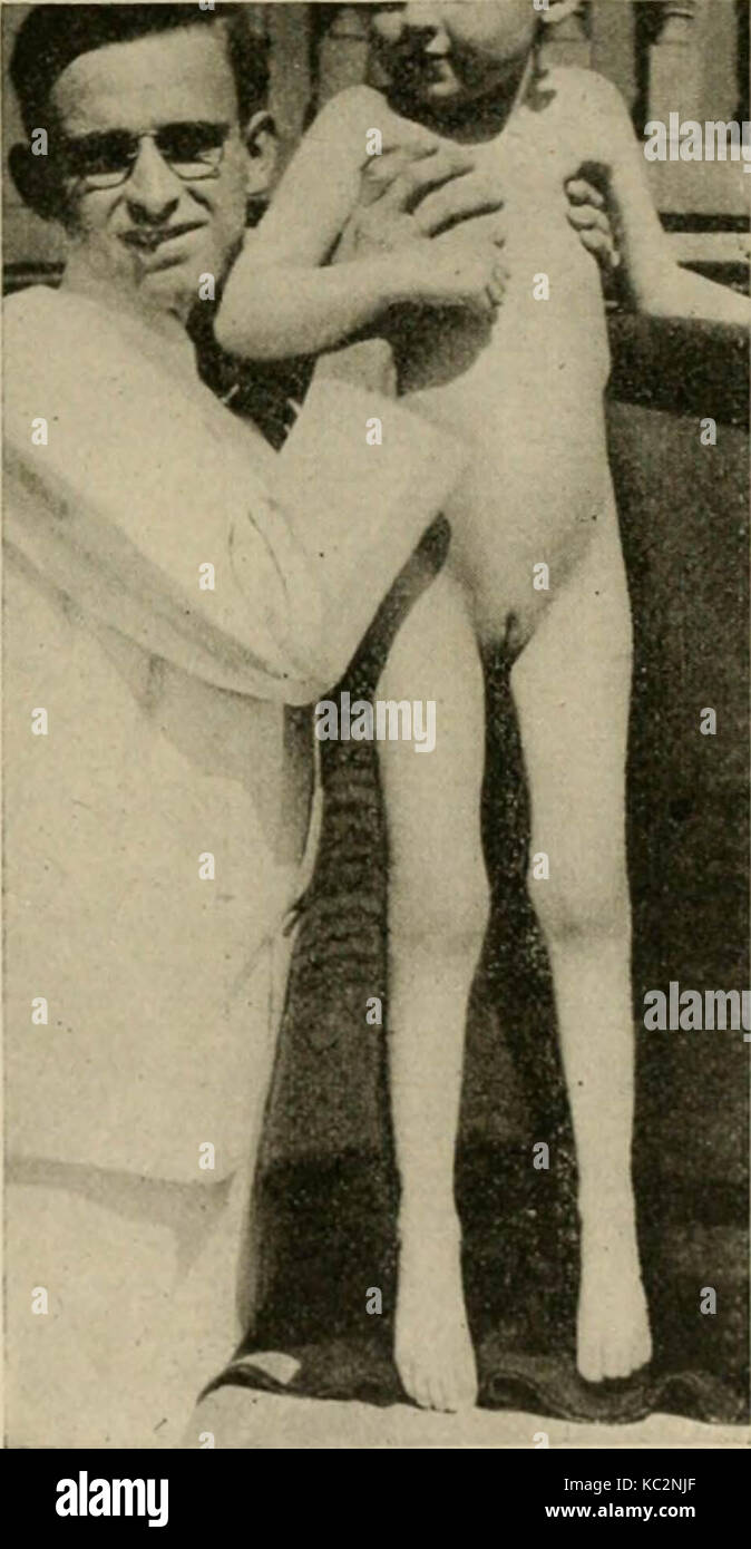 "Les maladies des nourrissons et des enfants (1919) Banque D'Images