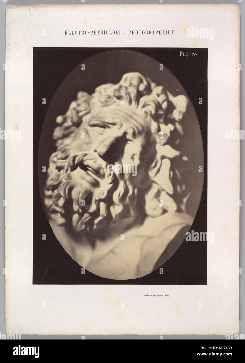 Figure 70 : chef de l'Laocoön de Rome, Guillaume-Benjamin Duchenne de Boulogne-Amand, 1854-56, 1862 imprimé Banque D'Images