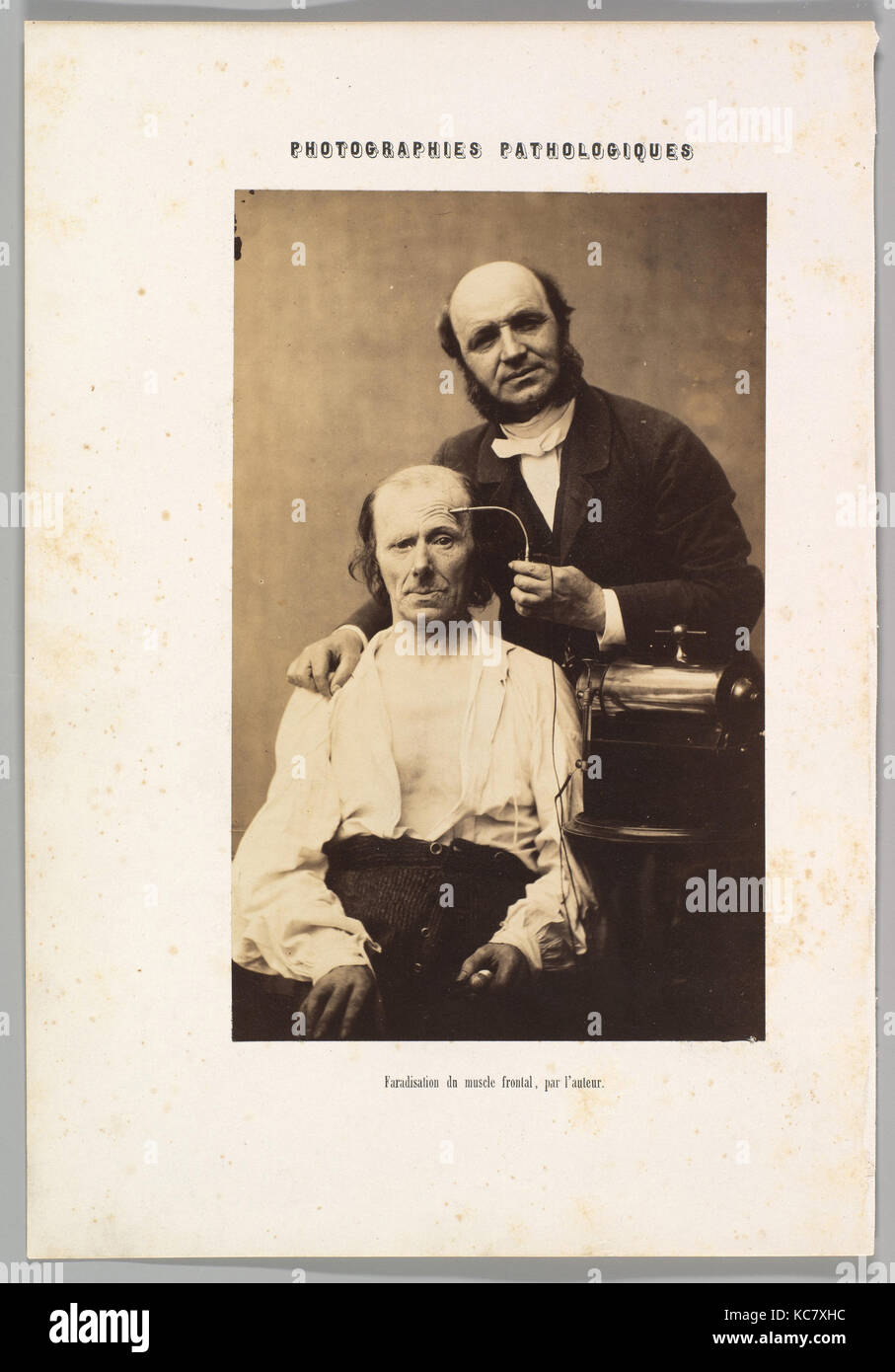 Faradisation du muscle frontal, Guillaume-Benjamin Duchenne de Boulogne-Amand, 1854-56, 1862 imprimé Banque D'Images