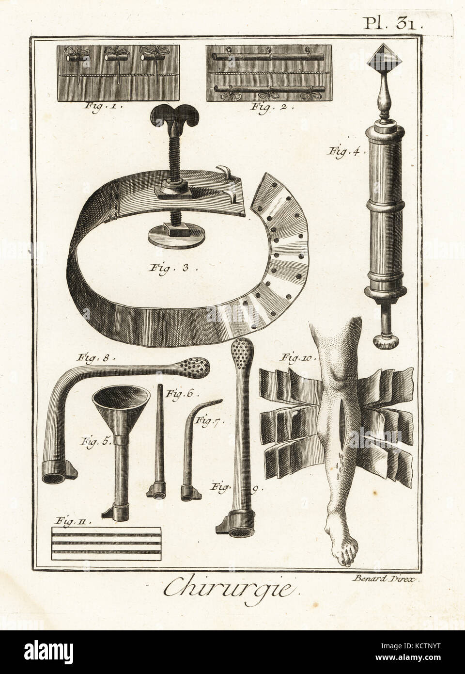 18e siècle 1,2 sutures, garrot, 3 Dominique Lion's fine pointes 4 seringue siphon, 5 tubes d'injection, 6-9, 18 feuilles bandage pour les fractures complexes 10 et classé comprimer 11. La gravure sur cuivre par Robert Benard de Denis Diderot's Encyclopedia, Pellet, Genève, 1779. Banque D'Images