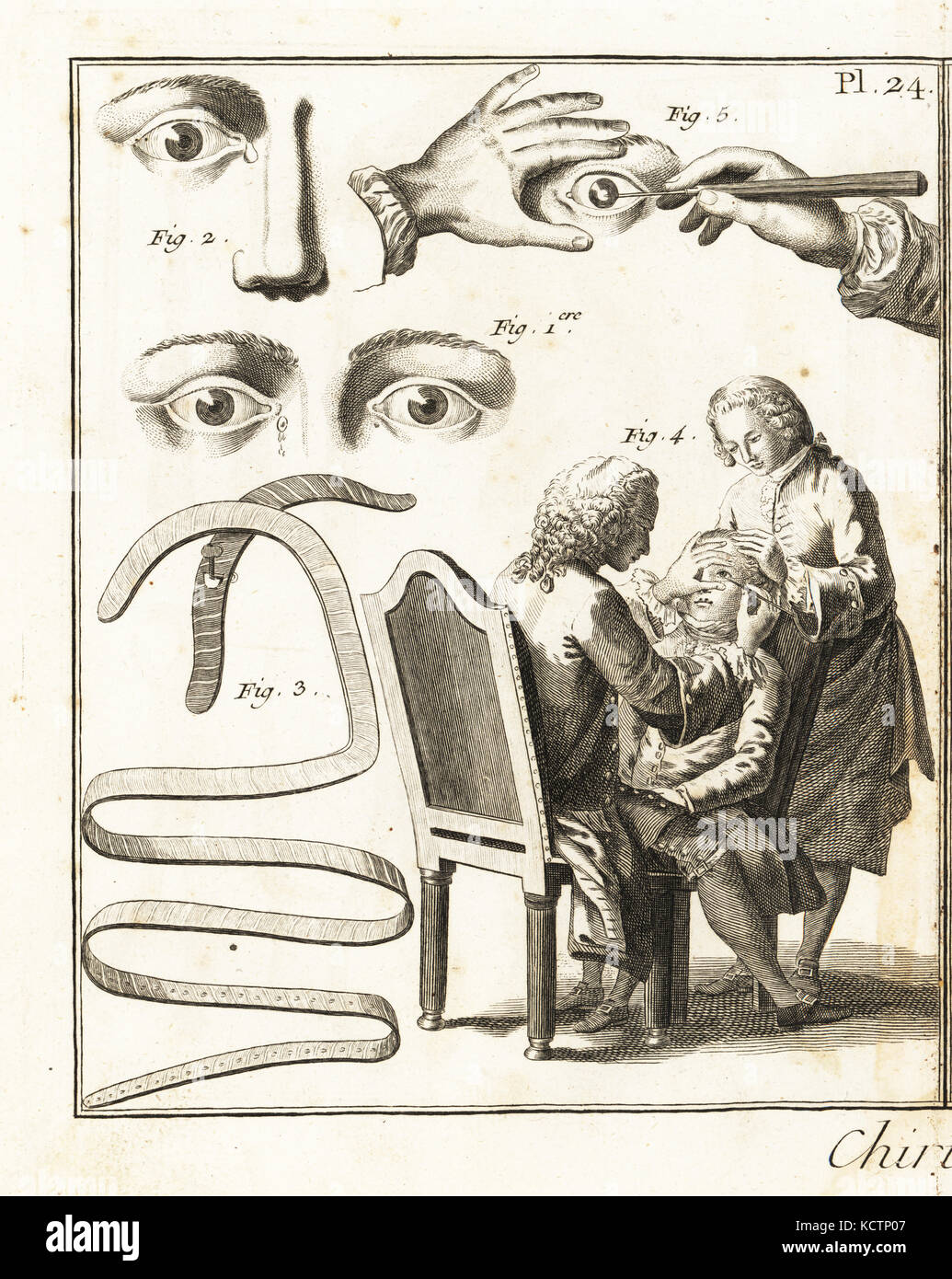 Glande lacrymale 1,2 conditions, les bandages de glande lacrymale de l'enflure et la chirurgie de la cataracte, 3 4,5, 18ème siècle. La gravure sur cuivre par Robert Benard de Denis Diderot's Encyclopedia, Pellet, Genève, 1779. Banque D'Images