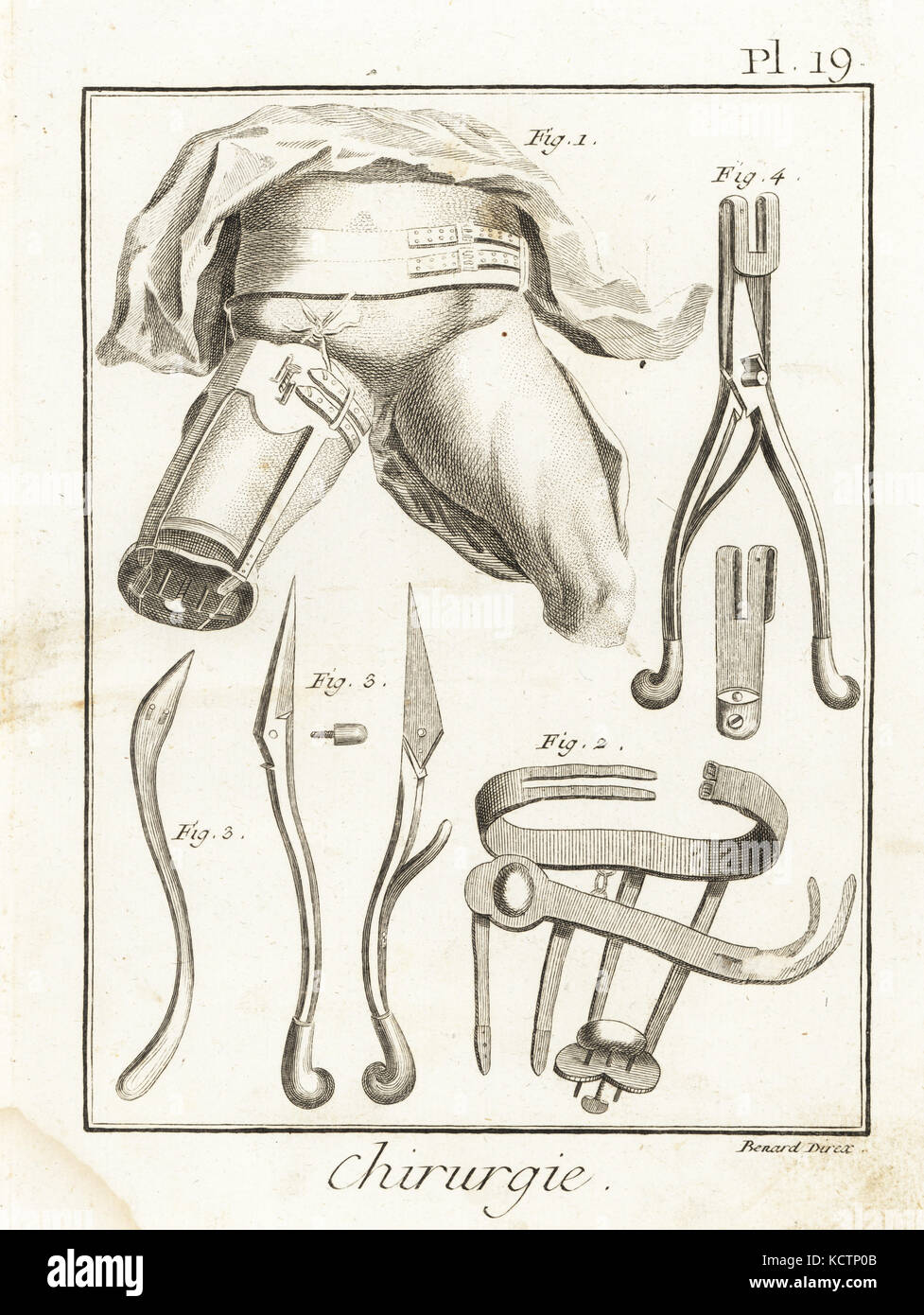 Jean Louis Petit's machine à comprimer l'artère fémorale au cours de l'amputation de la cuisse, 1 bandages 2 et 3 de l'aiguille de l'anévrisme, et ciseaux 4. La gravure sur cuivre par Robert Benard de Denis Diderot's Encyclopedia, Pellet, Genève, 1779. Banque D'Images Jean Louis Petit's machine à comprimer l'artère fémorale au cours de l'amputation de la cuisse, 1 bandages 2 et 3 de l'aiguille de l'anévrisme, et ciseaux 4. La gravure sur cuivre par Robert Benard de Denis Diderot's Encyclopedia, Pellet, Genève, 1779. Banque D'Images