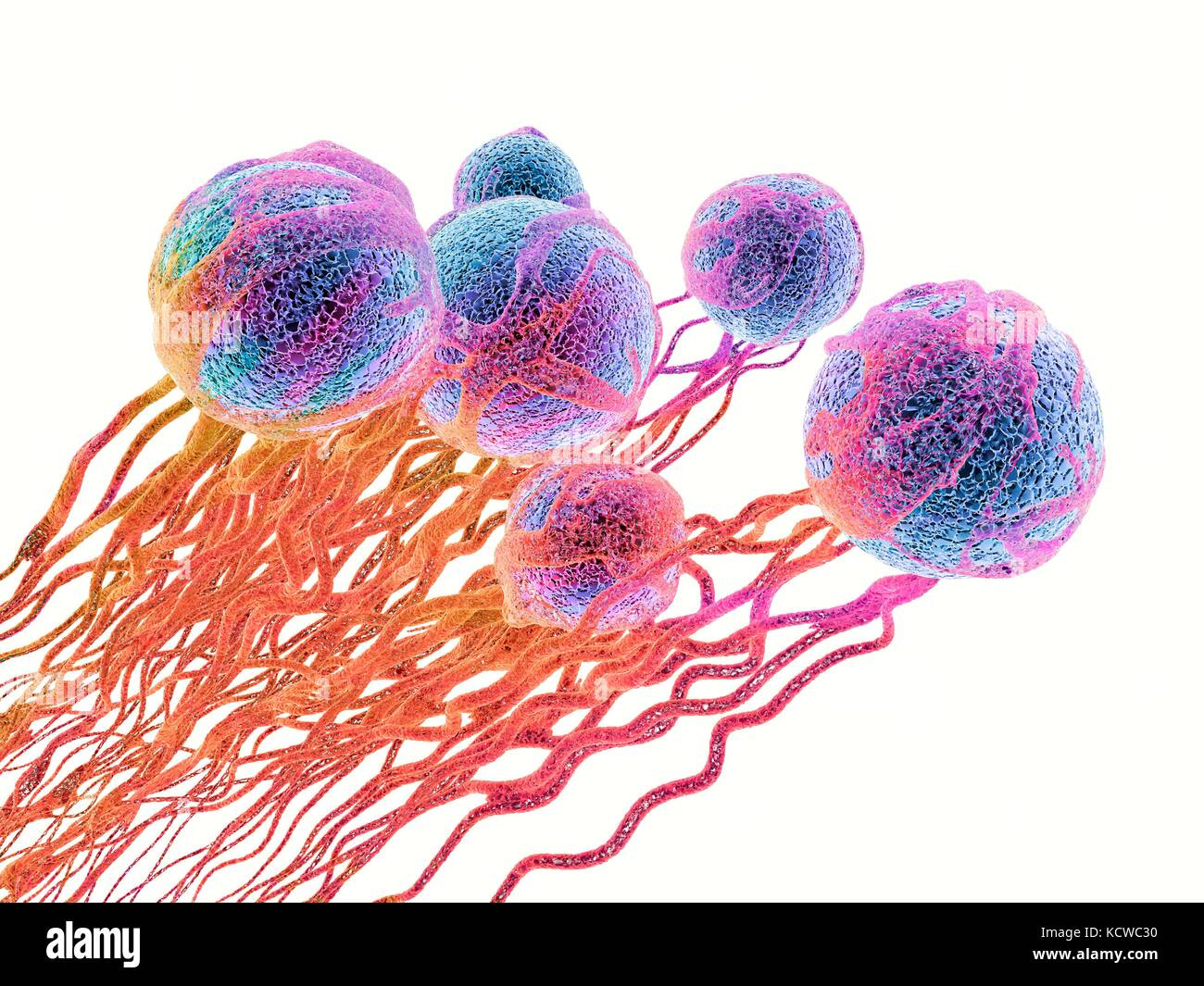 Des cellules de cancer. Illustration d'ordinateur des cellules de cancer, montrant la formation de vaisseaux sanguins fournissant les cellules de l'oxygènes et nutrigens avec. Les cellules avec leurs noyaux sont affichés en bleu. Banque D'Images